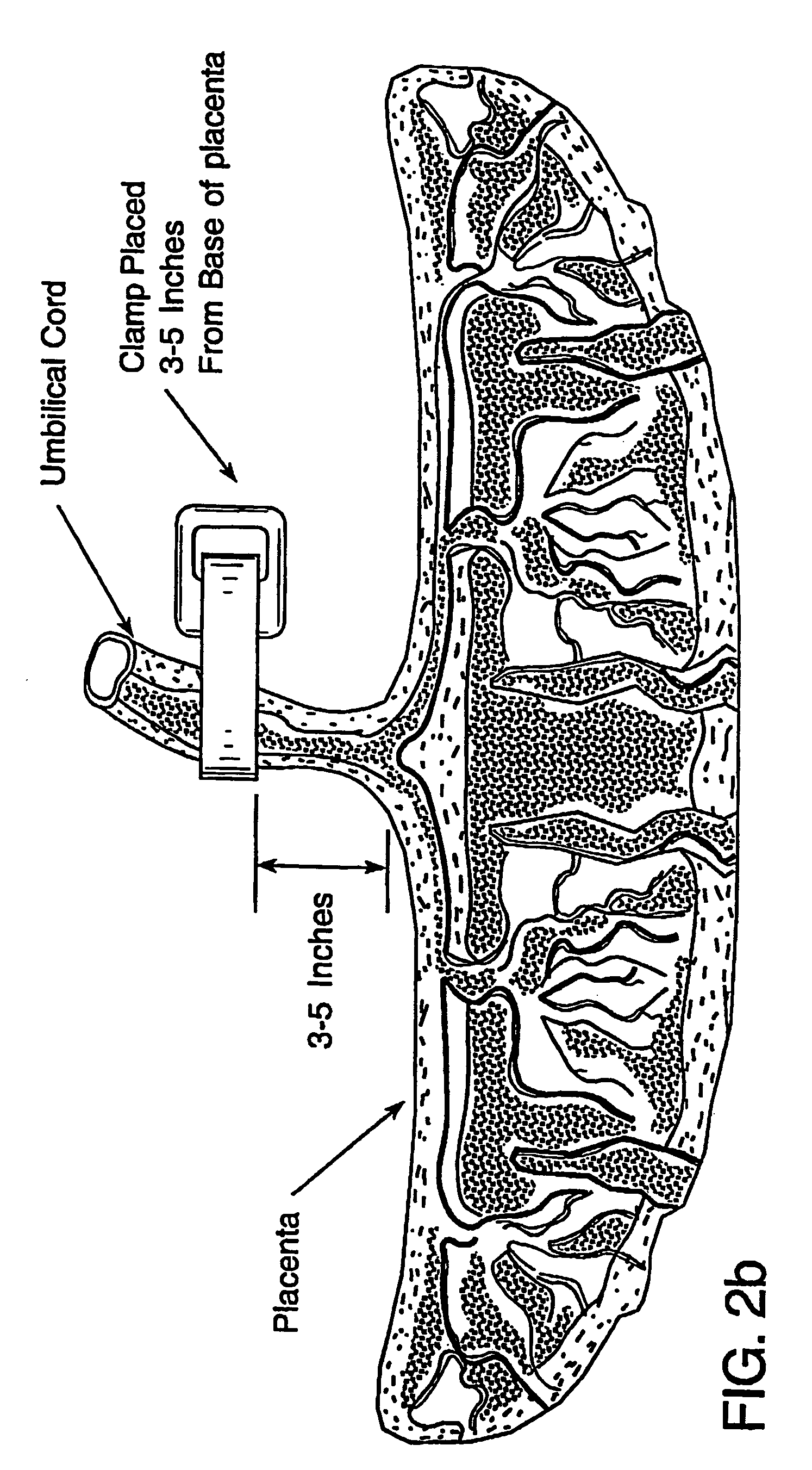 Tissue matrices comprising placental stem cells, and methods of making the same