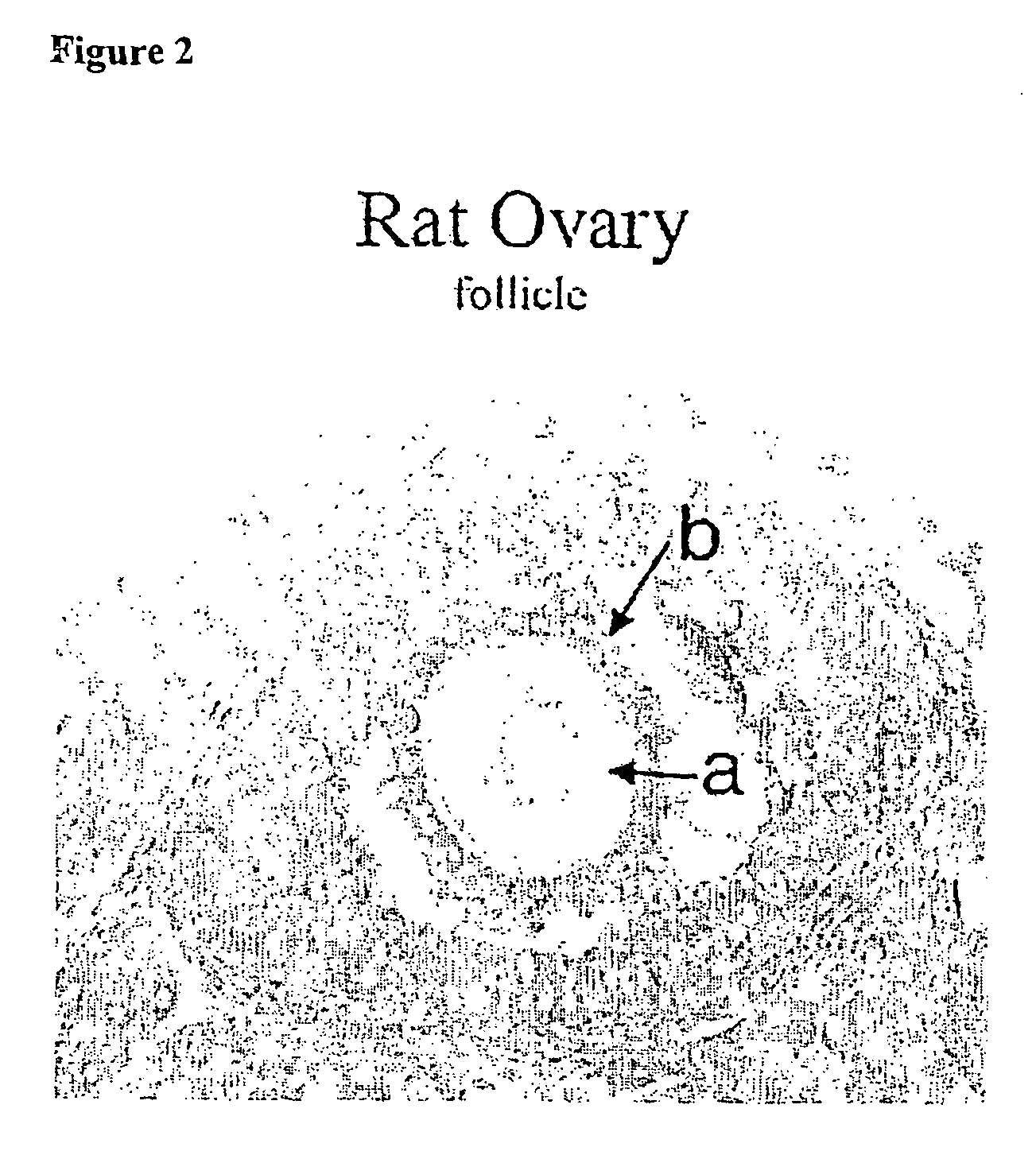 Method for detecting the affinity of folate receptor auto antibodies