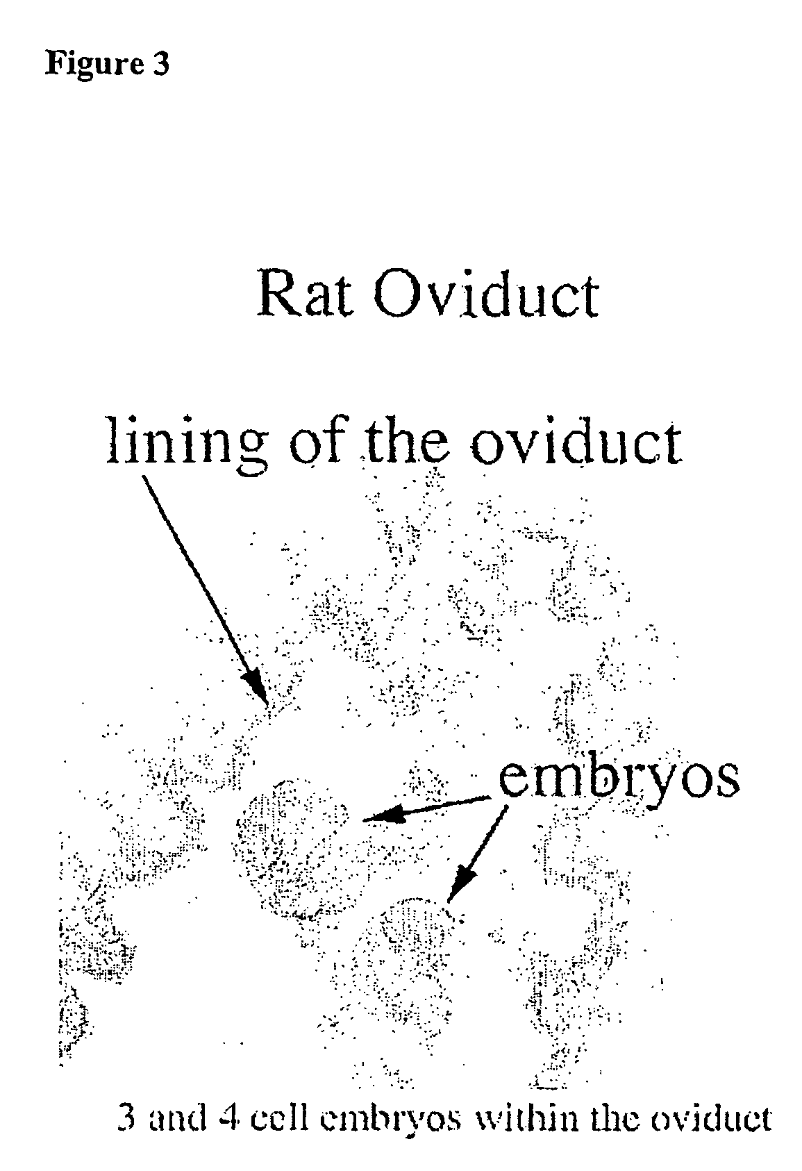 Method for detecting the affinity of folate receptor auto antibodies