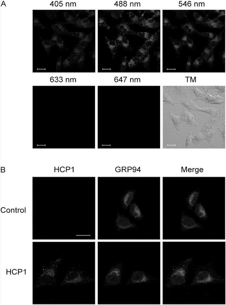 Application of 7-hydroxycoumarin pyrazoline derivative in preparing GRP94 inhibitors