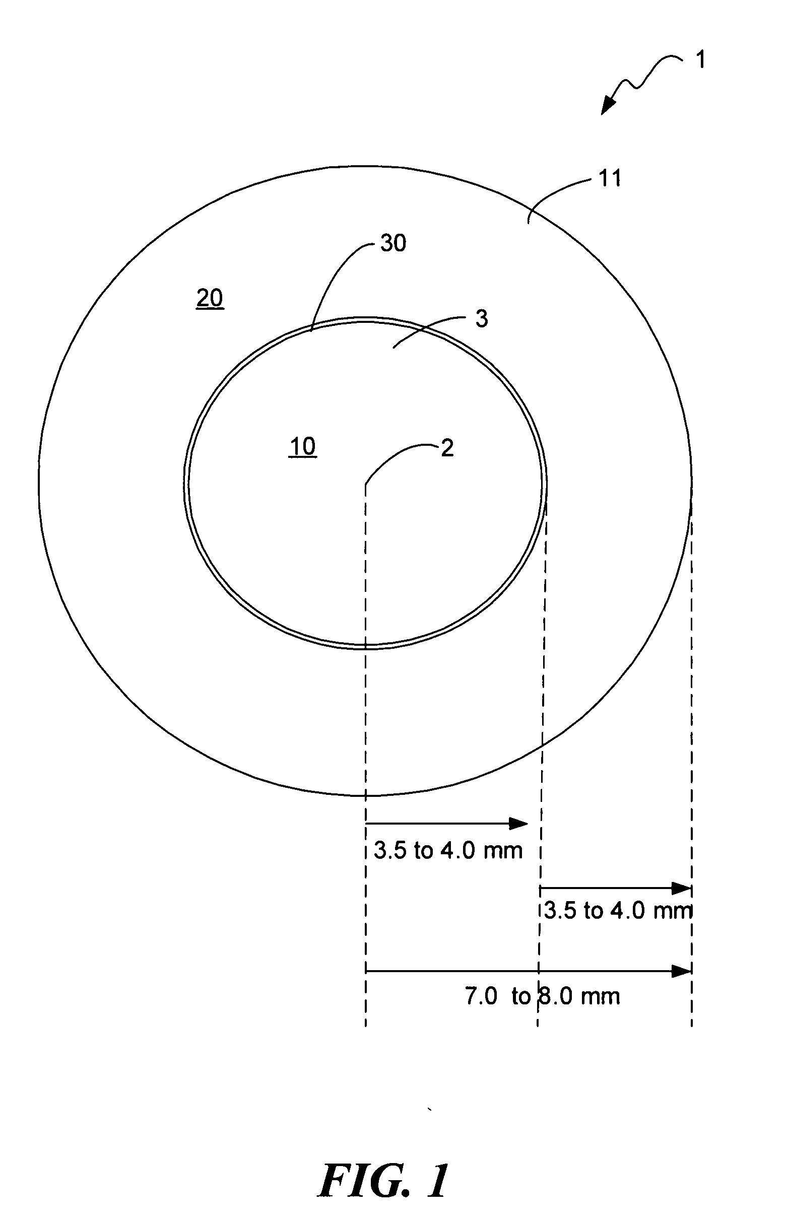 Lens having an optically controlled peripheral portion and a method for designing and manufacturing the lens