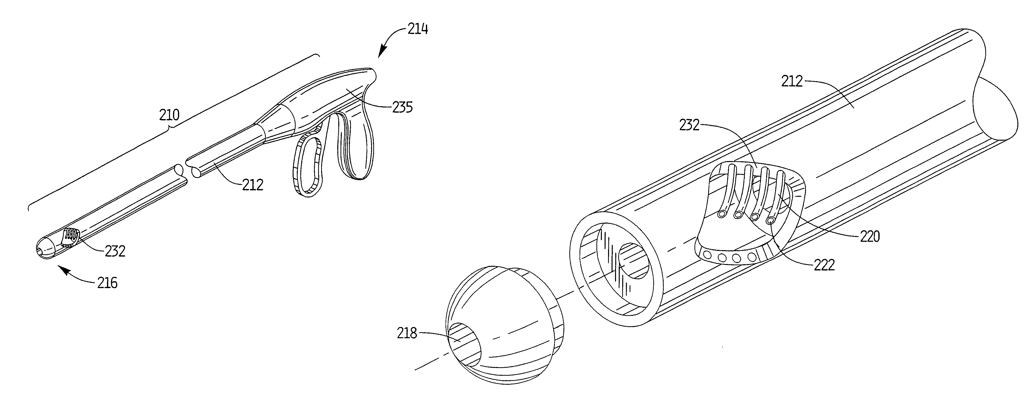 Apparatus and method for treating gastroesophageal reflux disease