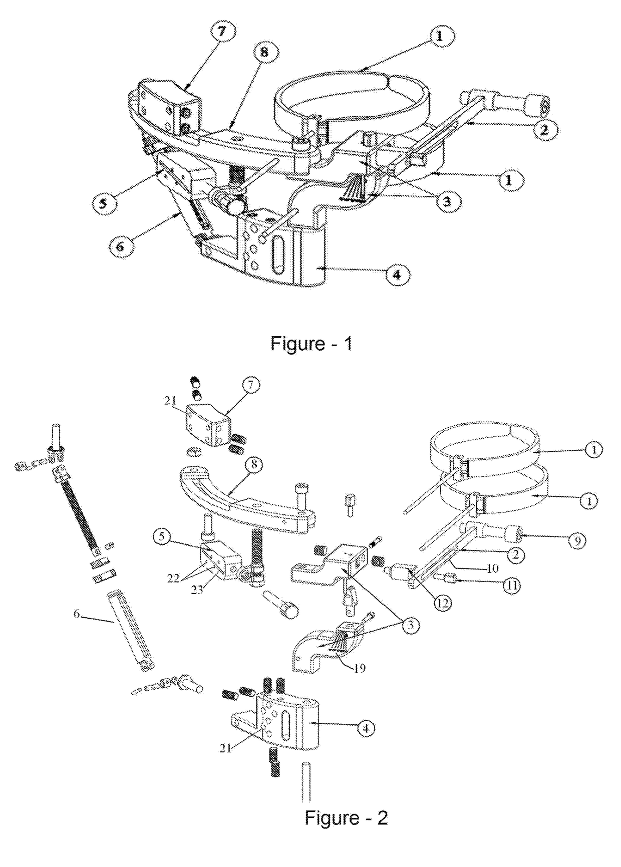 High tibial osteotomy external fixator