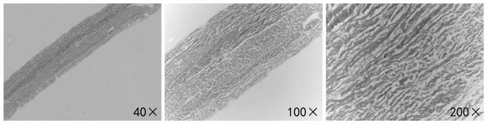 Acellular matrix urethral suspension repair material and its preparation method and application