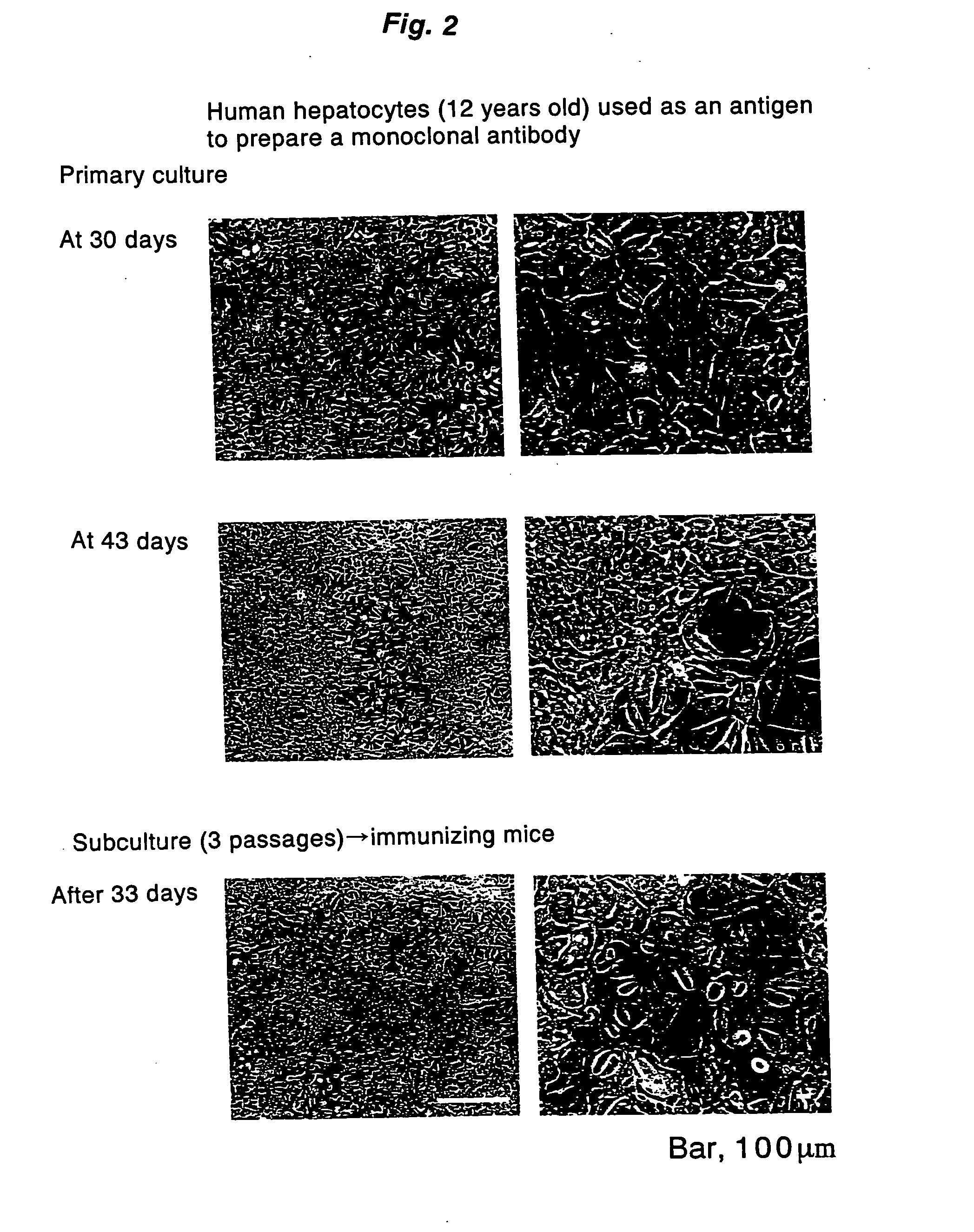 Antibody recognizing proliferative human liver cells proliferative human liver cells and functional human liver cells