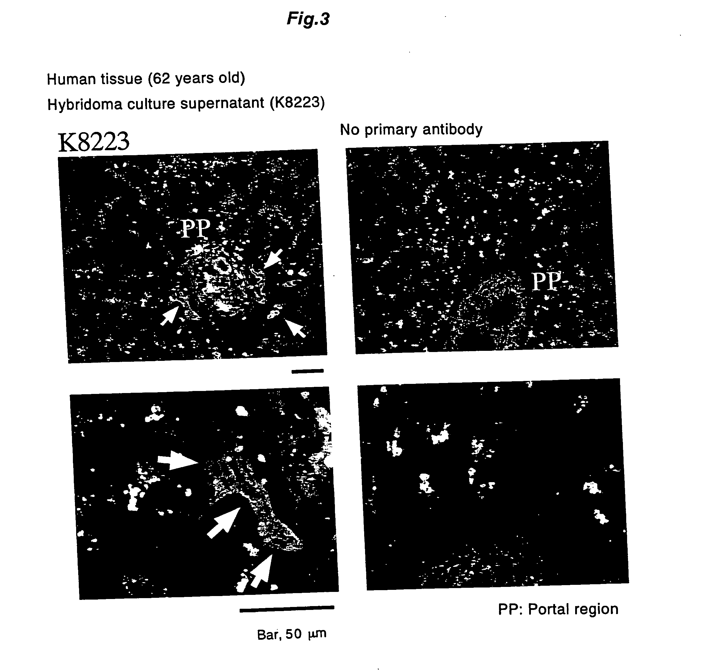 Antibody recognizing proliferative human liver cells proliferative human liver cells and functional human liver cells