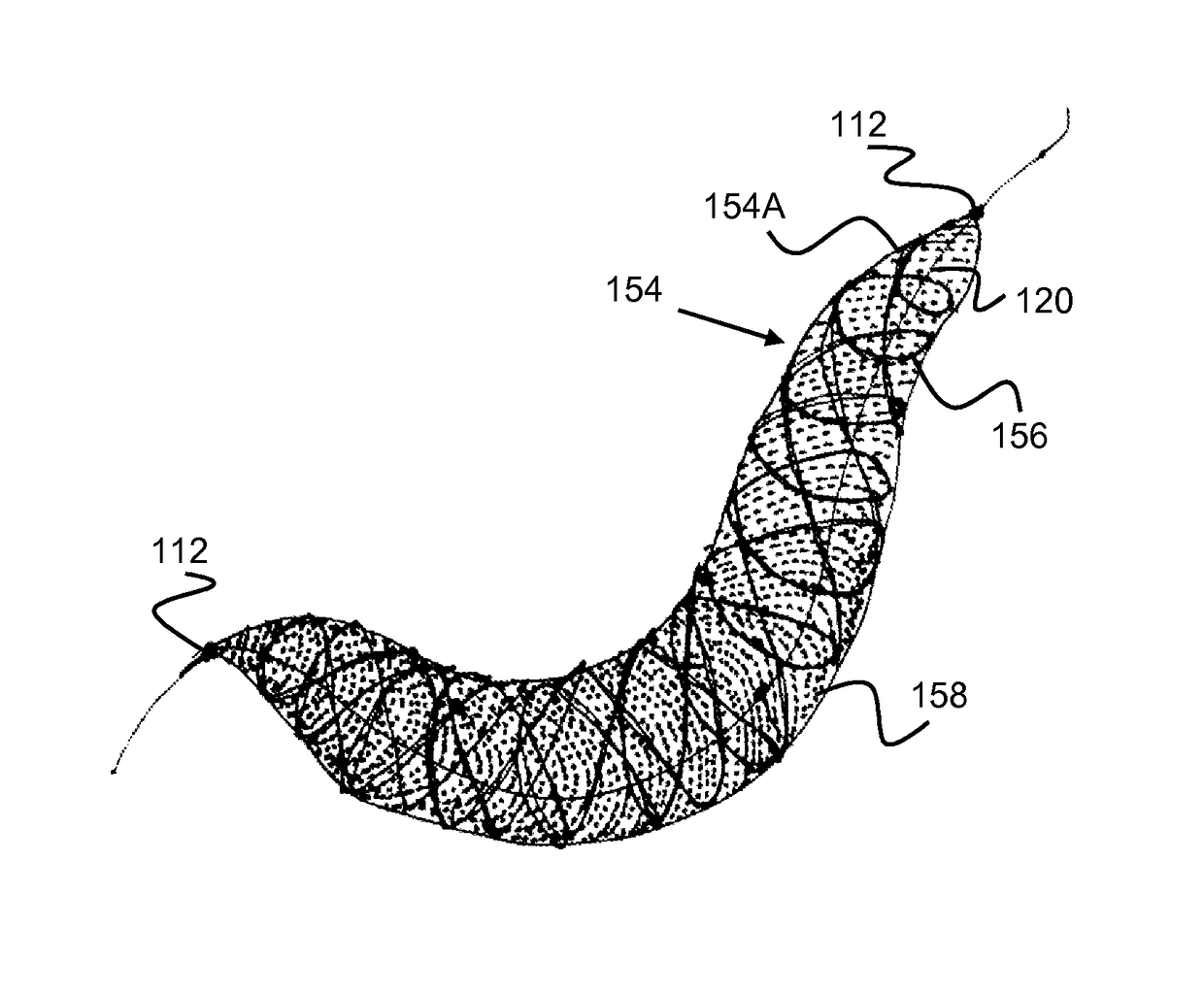 Methods and devices for embolic protection