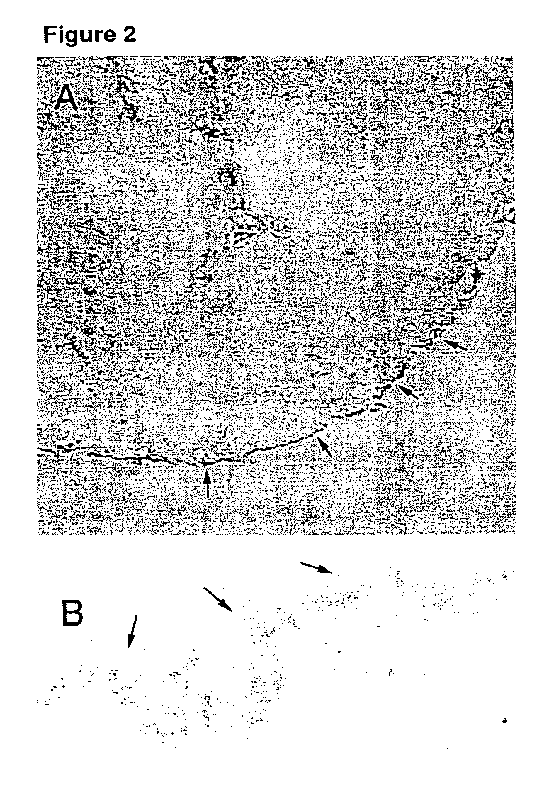 Human ovarian mesothelial cells and methods of isolation and uses thereof
