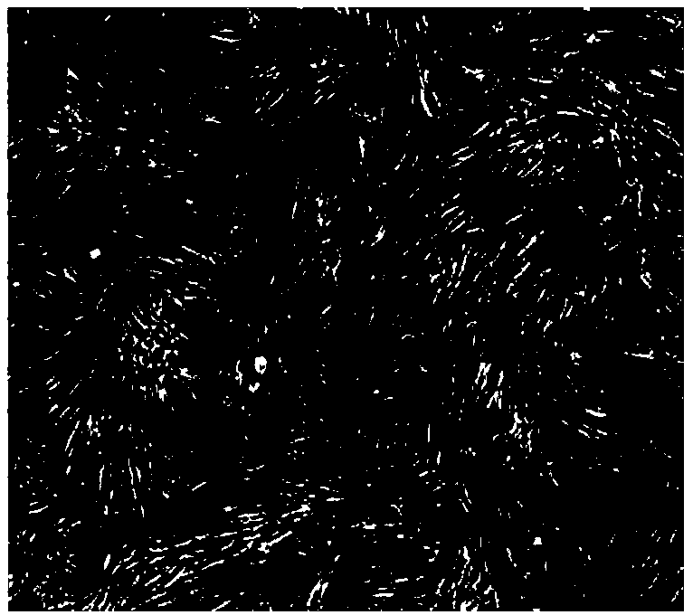 Cryopreservation pretreatment method for adipose-derived stem cells