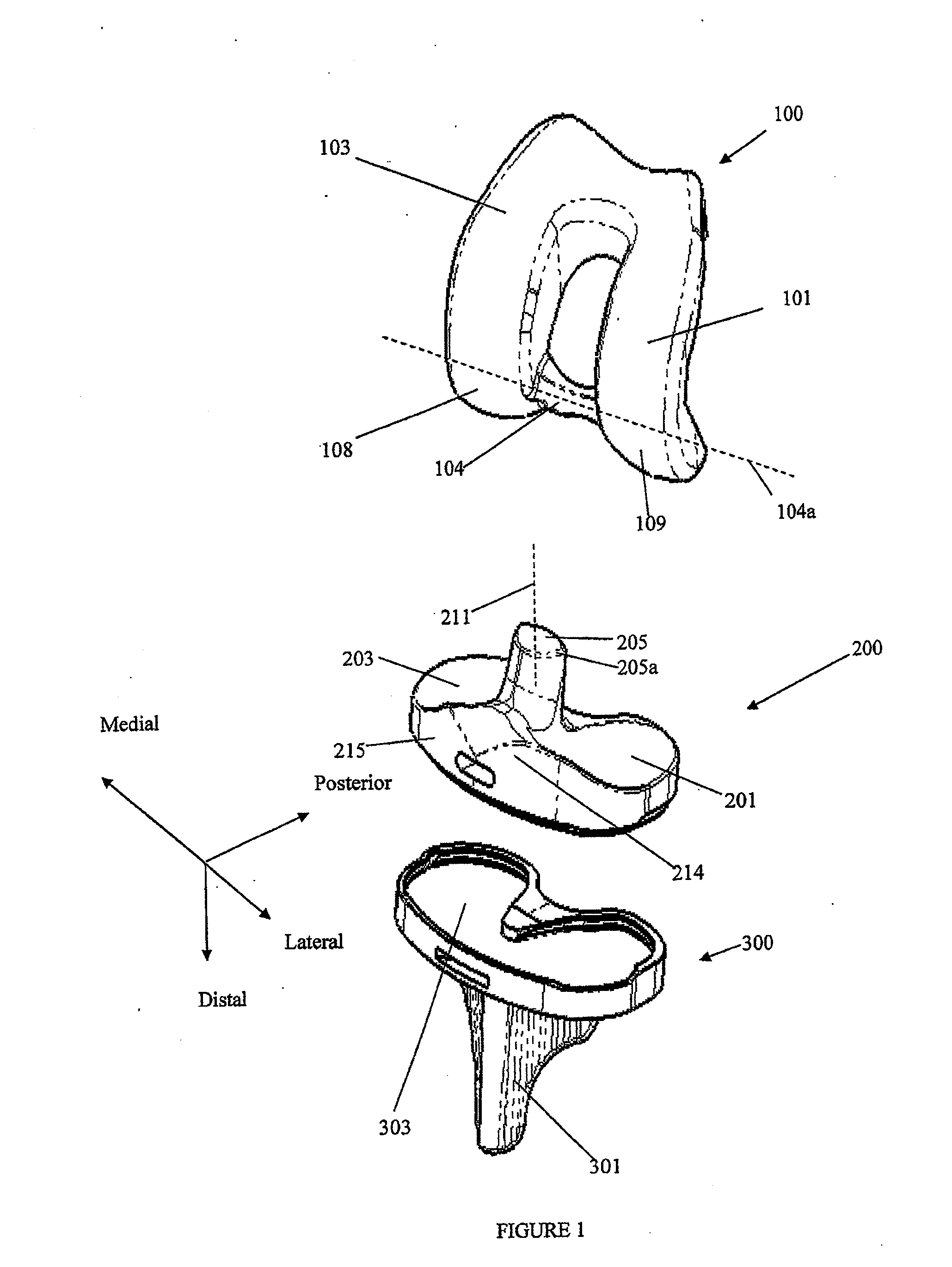 Prosthetic joint