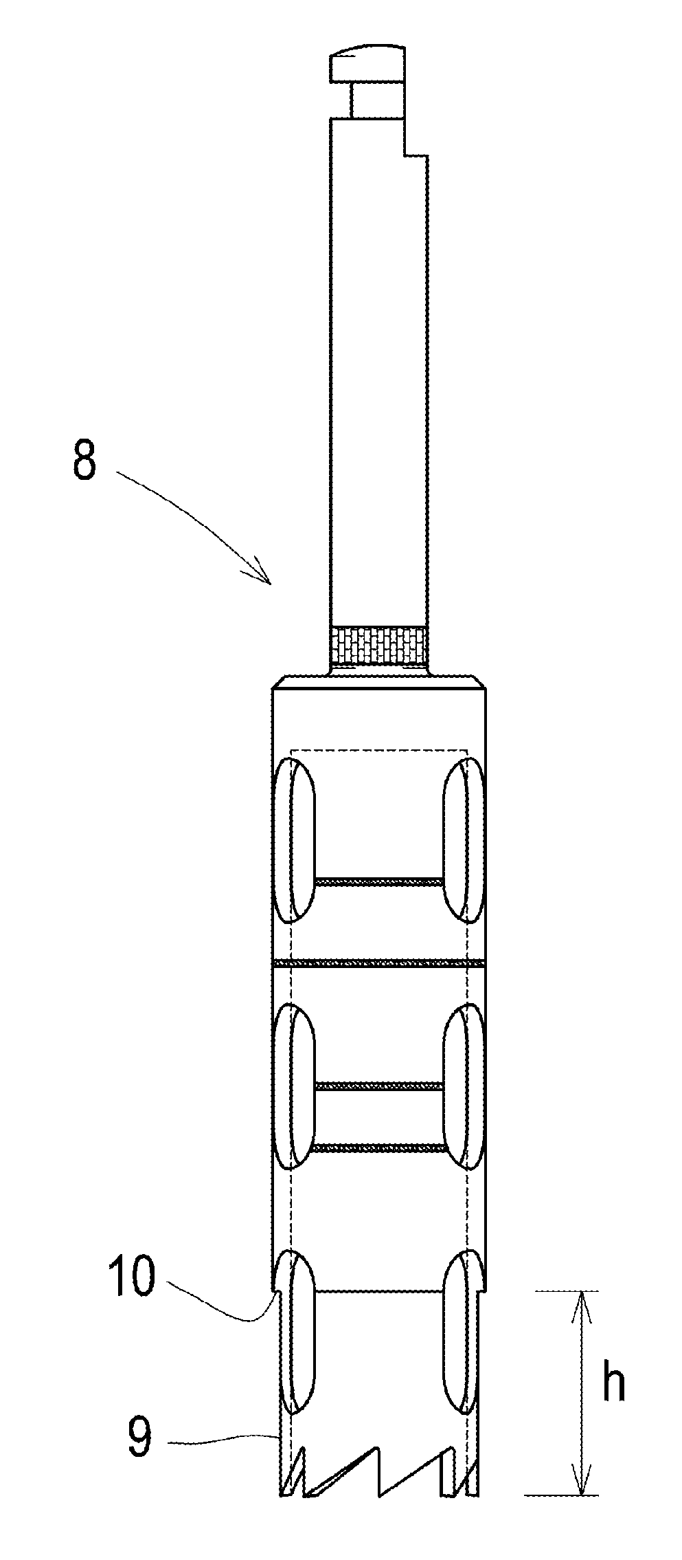 Implant extraction method and trephine drill bit for enabling the extraction
