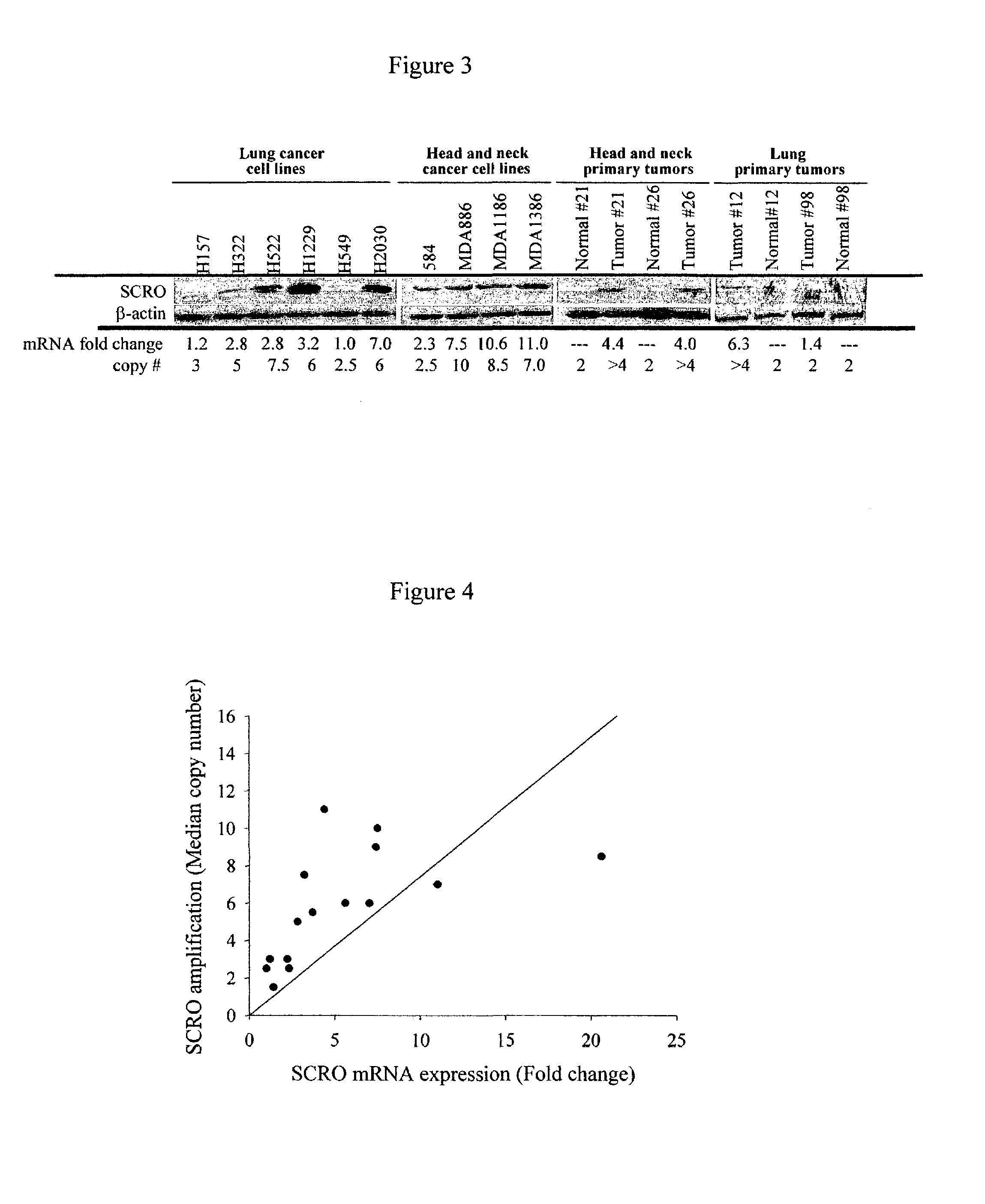 Carcinoma-related genes and polypeptides and methods of use thereof
