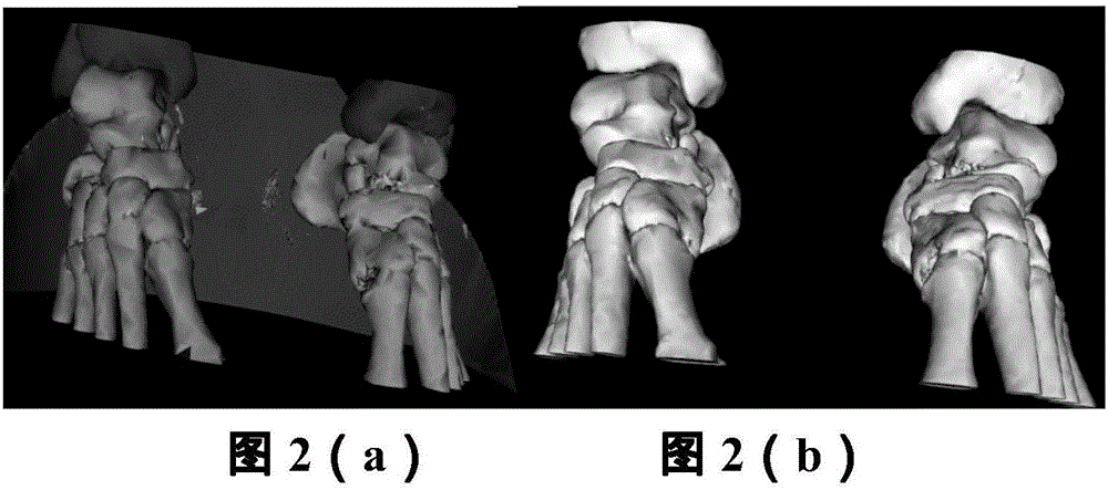 Medical image based segmentation and 3D reconstruction method and 3D printing system