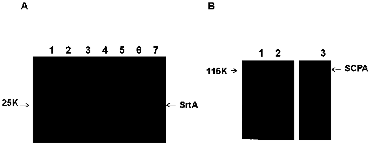 A combination vaccine for inhibiting and/or preventing type a streptococcal infection