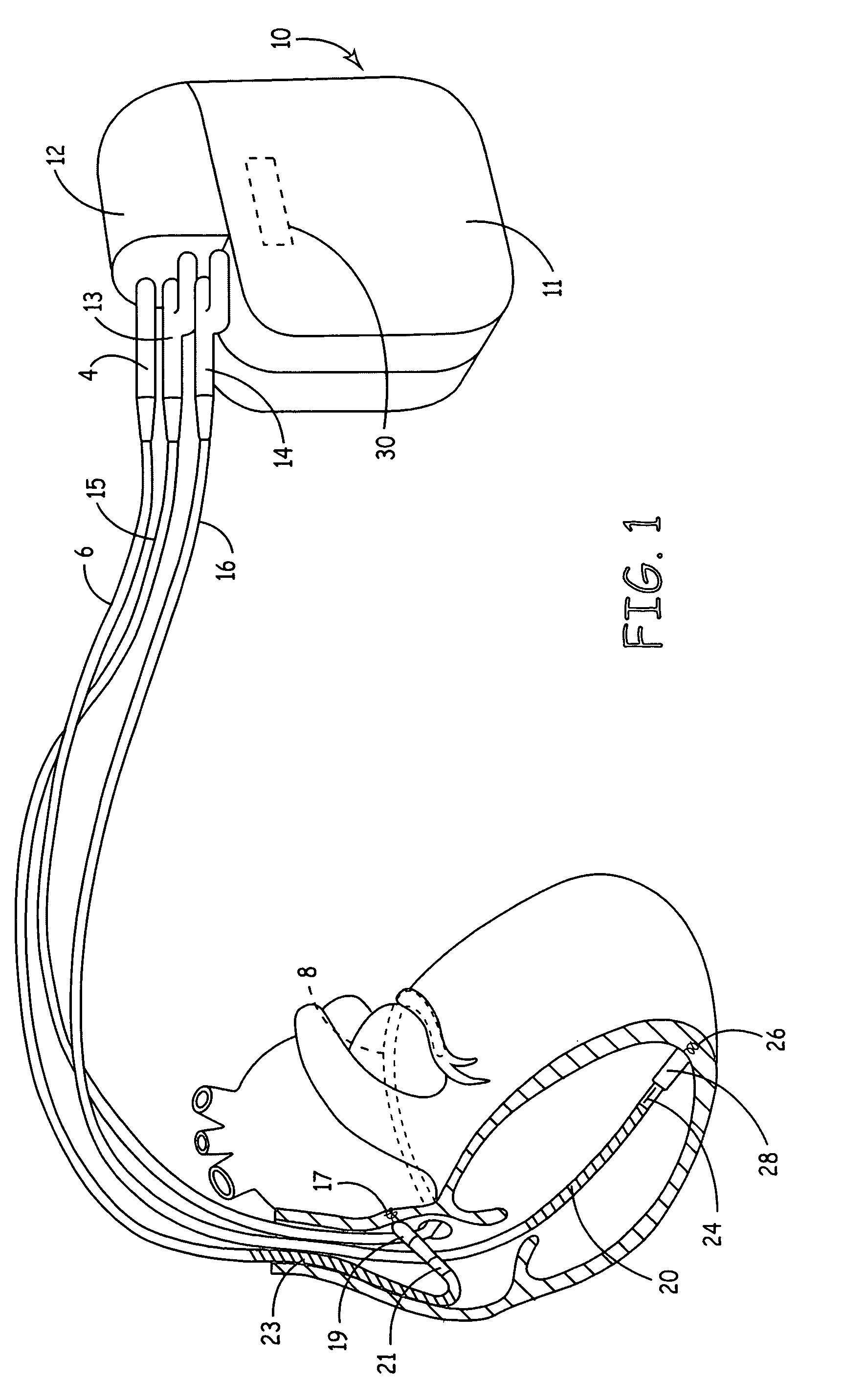 Method and apparatus for identifying lead-related conditions using prediction and detection criteria