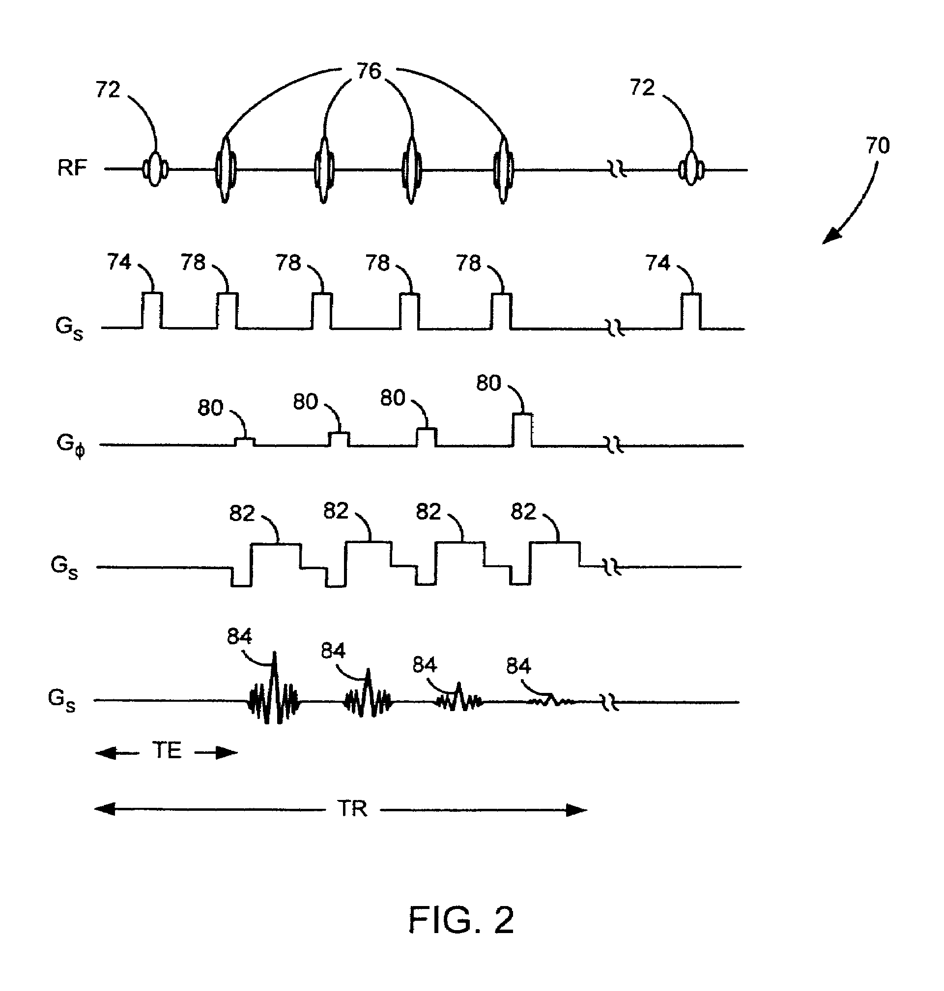 Method and apparatus to correct amplitude modulation in multi-echo magnetic resonance imaging