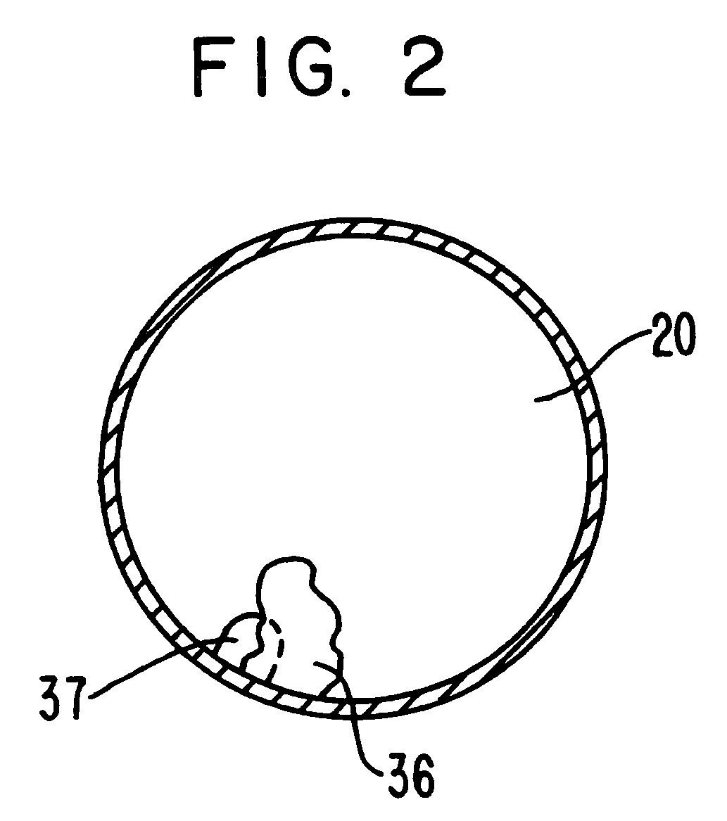 Apparatus and method for removing material from the colon
