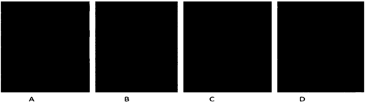 Application of chrysanthemum morifolium extract in preparation of medicine for preventing and treating cardiac hypertrophy