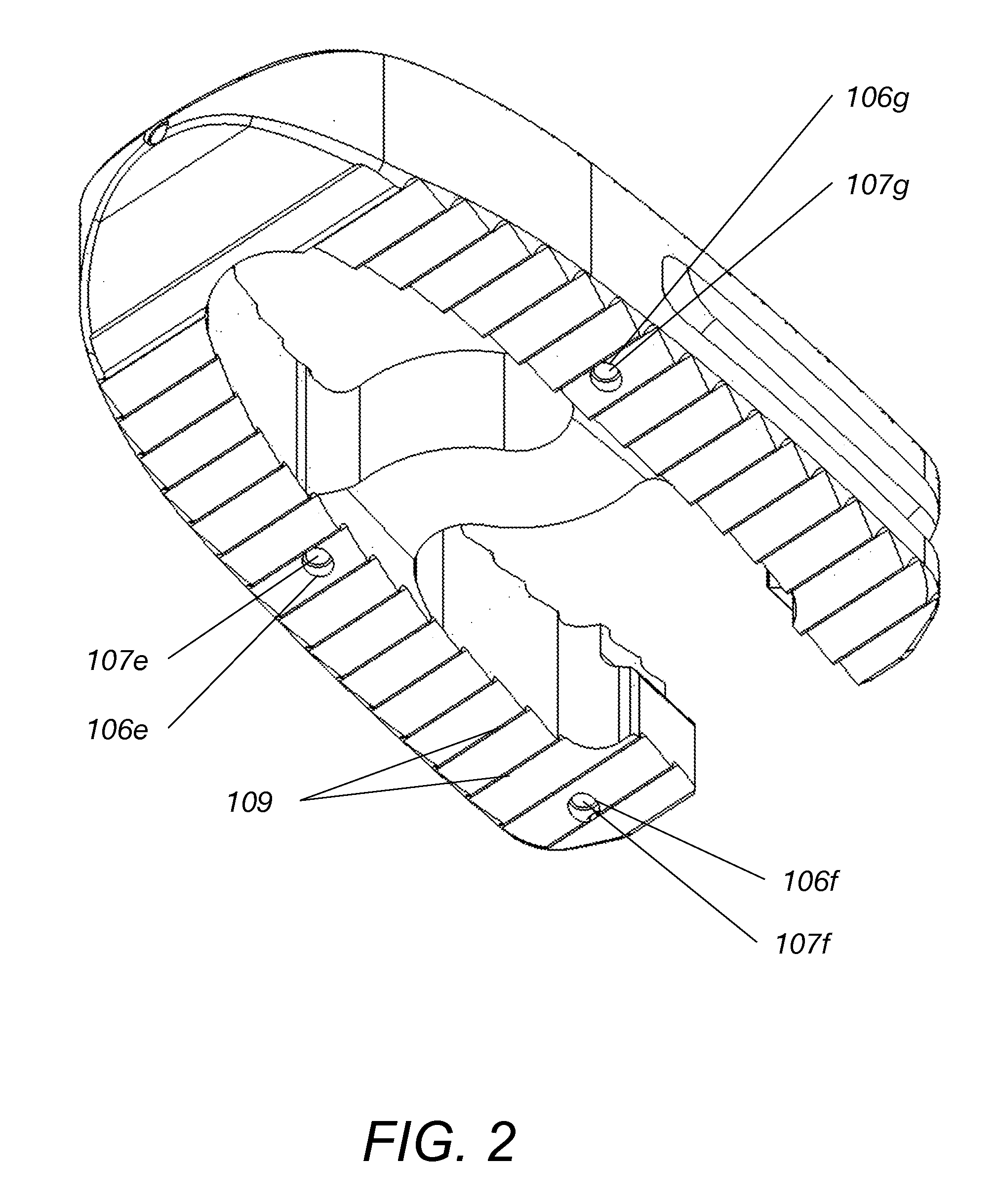 System and method for an intervertebral implant assembly