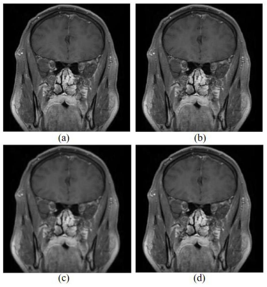 Intracranial blood vessel image registration and fusion method