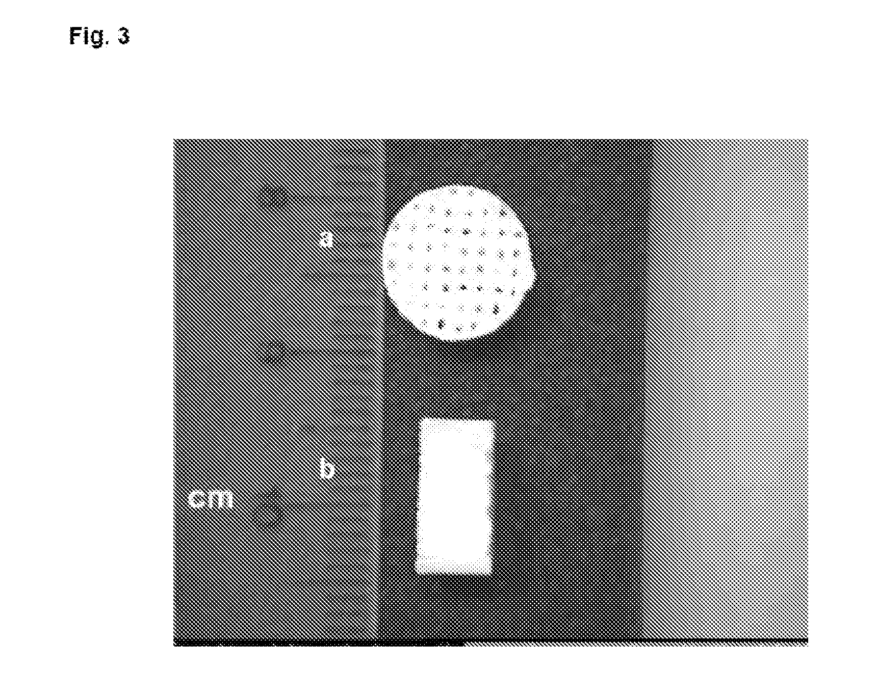 Three-dimensional matrices of structured porous monetite for tissue engineering and bone regeneration, and method of the preparation thereof