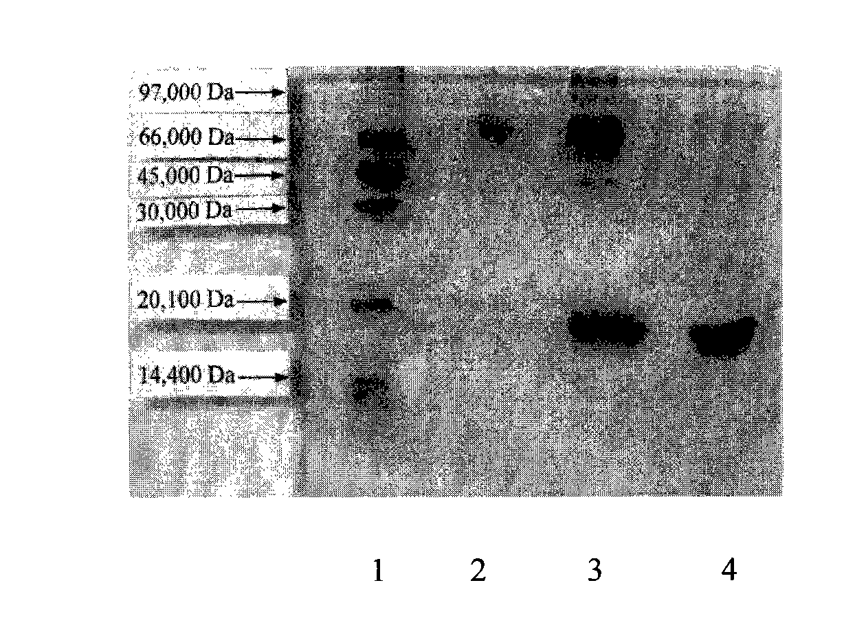 Human interferon alpha derivatives and preparation and use of pegylated products thereof