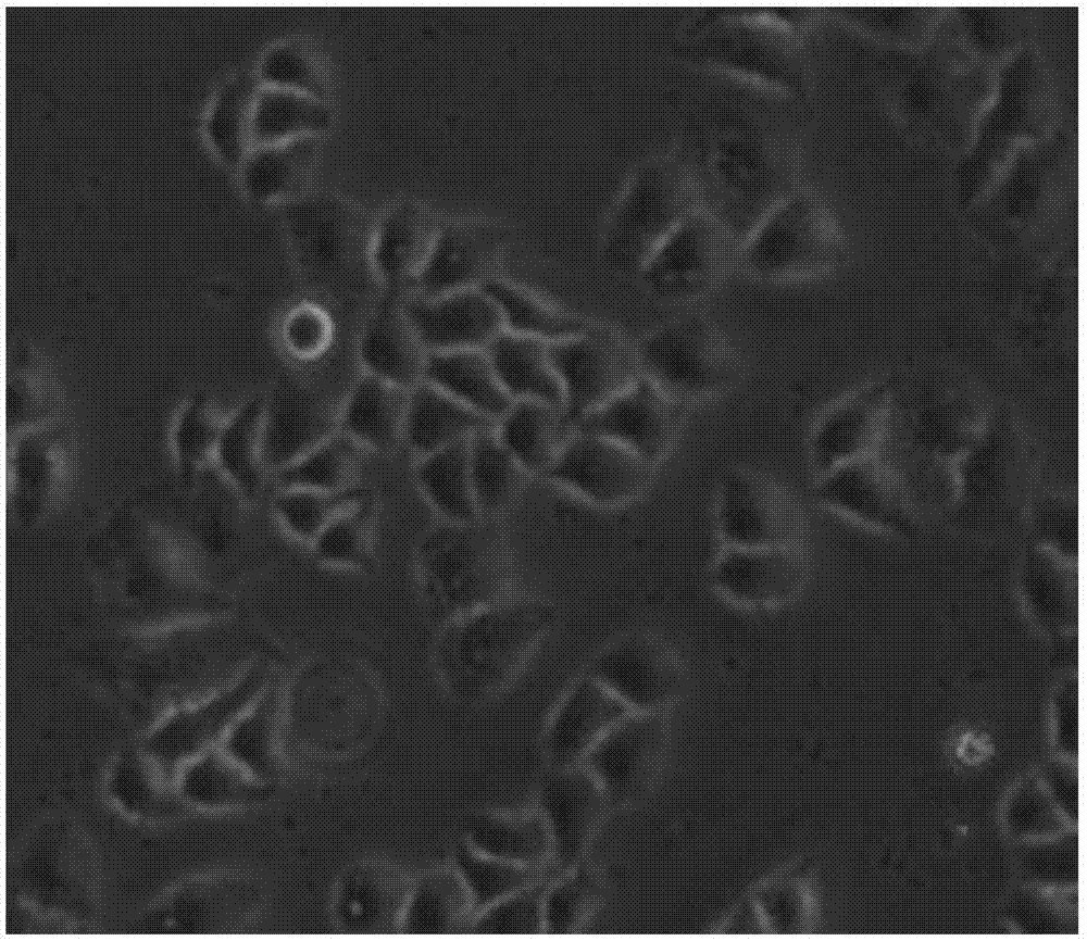 Method for establishing early metastasis model of esophageal squamous carcinoma