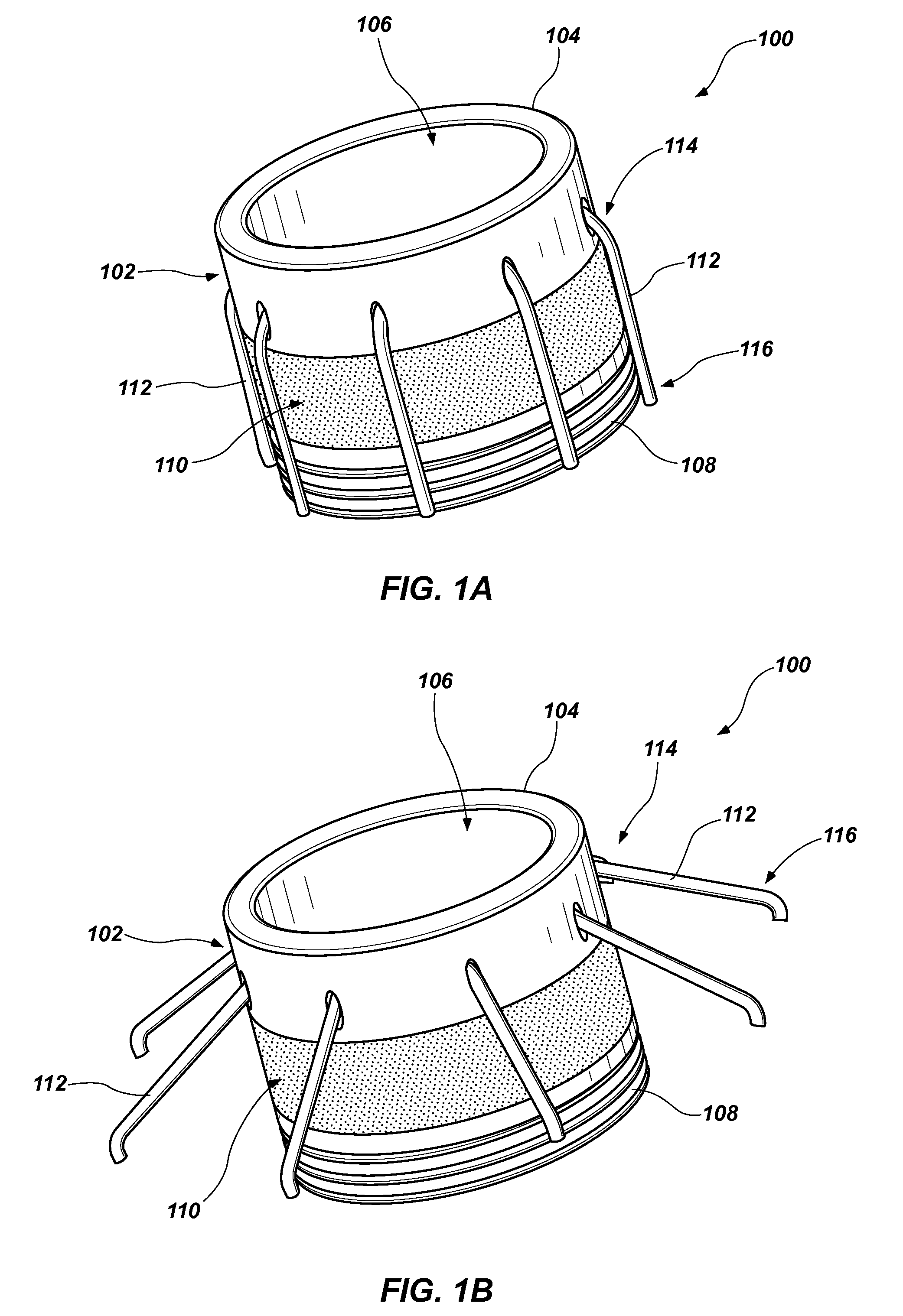 Cannula ring and related systems and methods