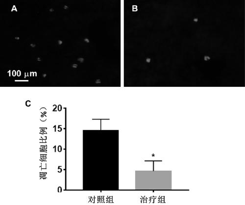Application of glutamate transporter-1 gene transfected glial cells in aspect of treating traumatic brain injury