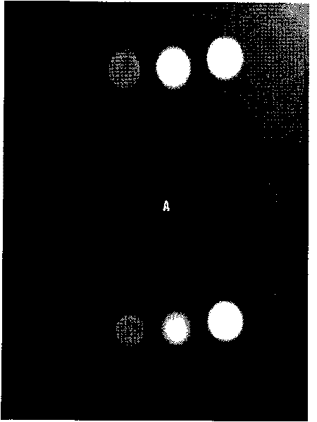 Contrast agent for MR cholangiopancreatography