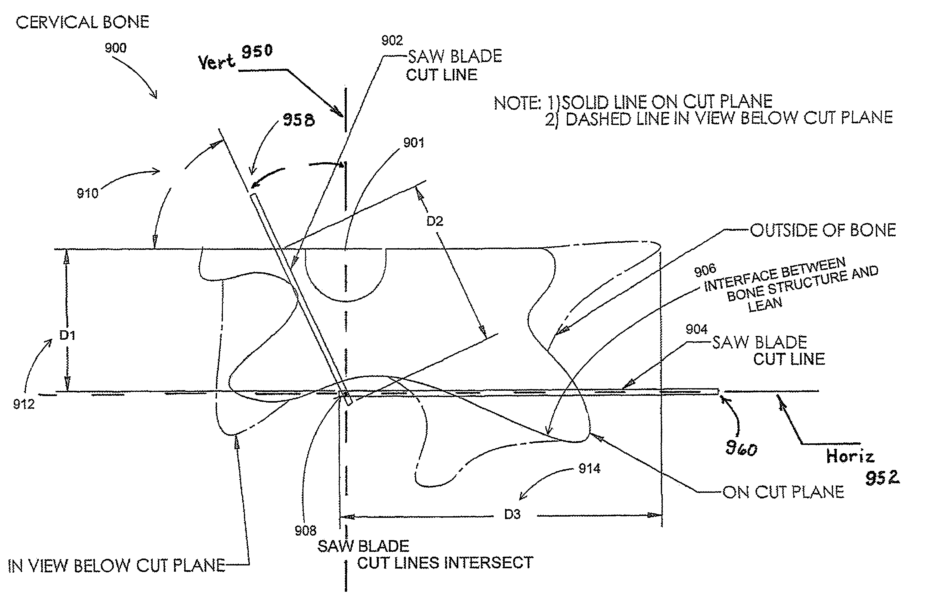Method and apparatus to load and remove bones from primals