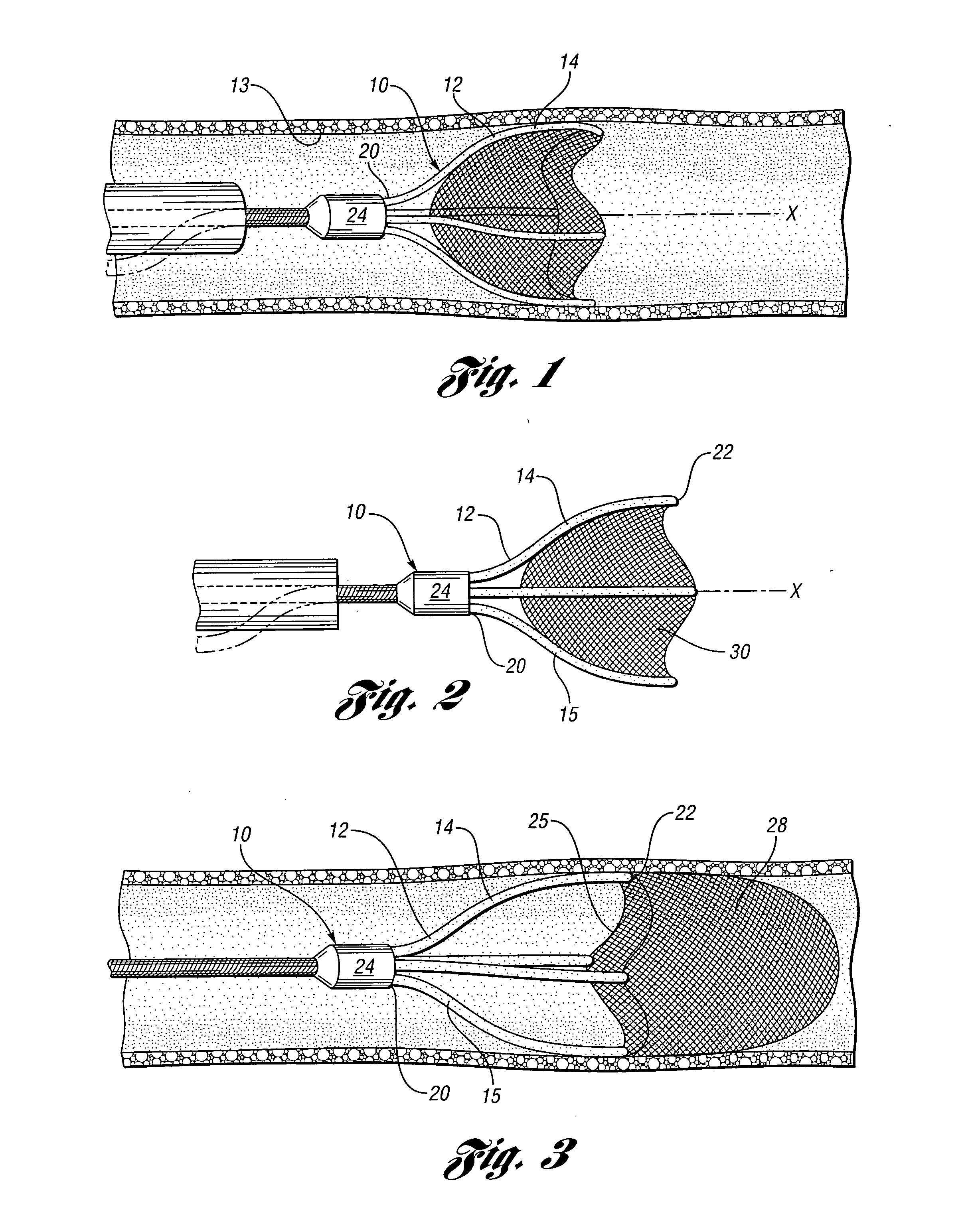 Embolic protection device having a filter