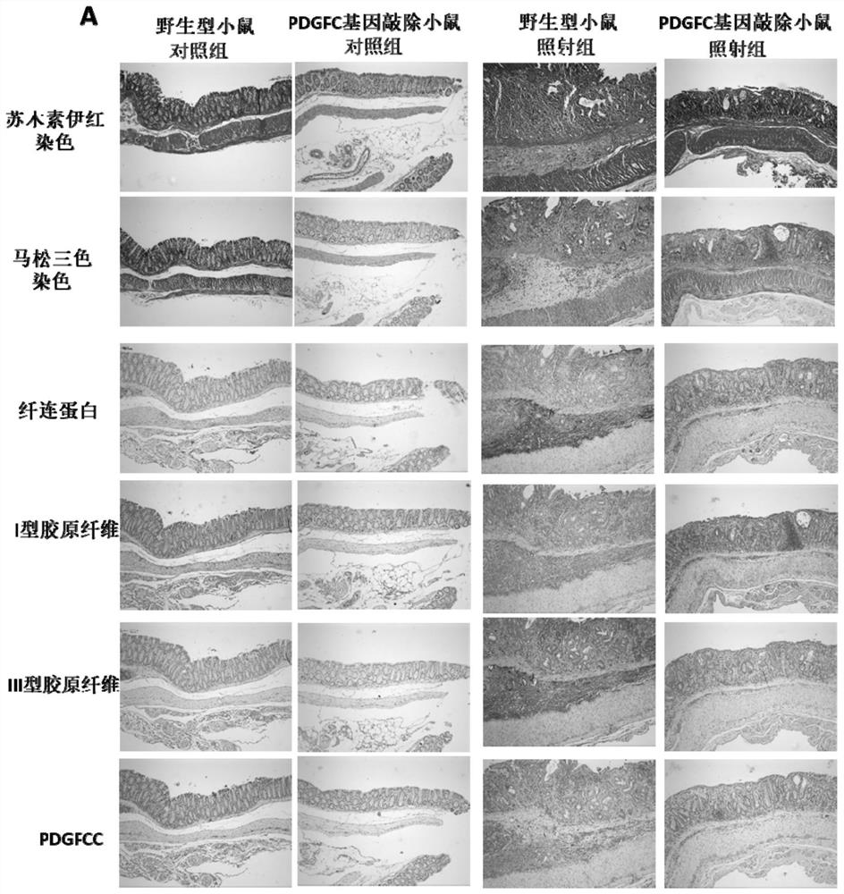 Use of pdf inhibitor for preparing medicine for treating intestinal inflammatory diseases