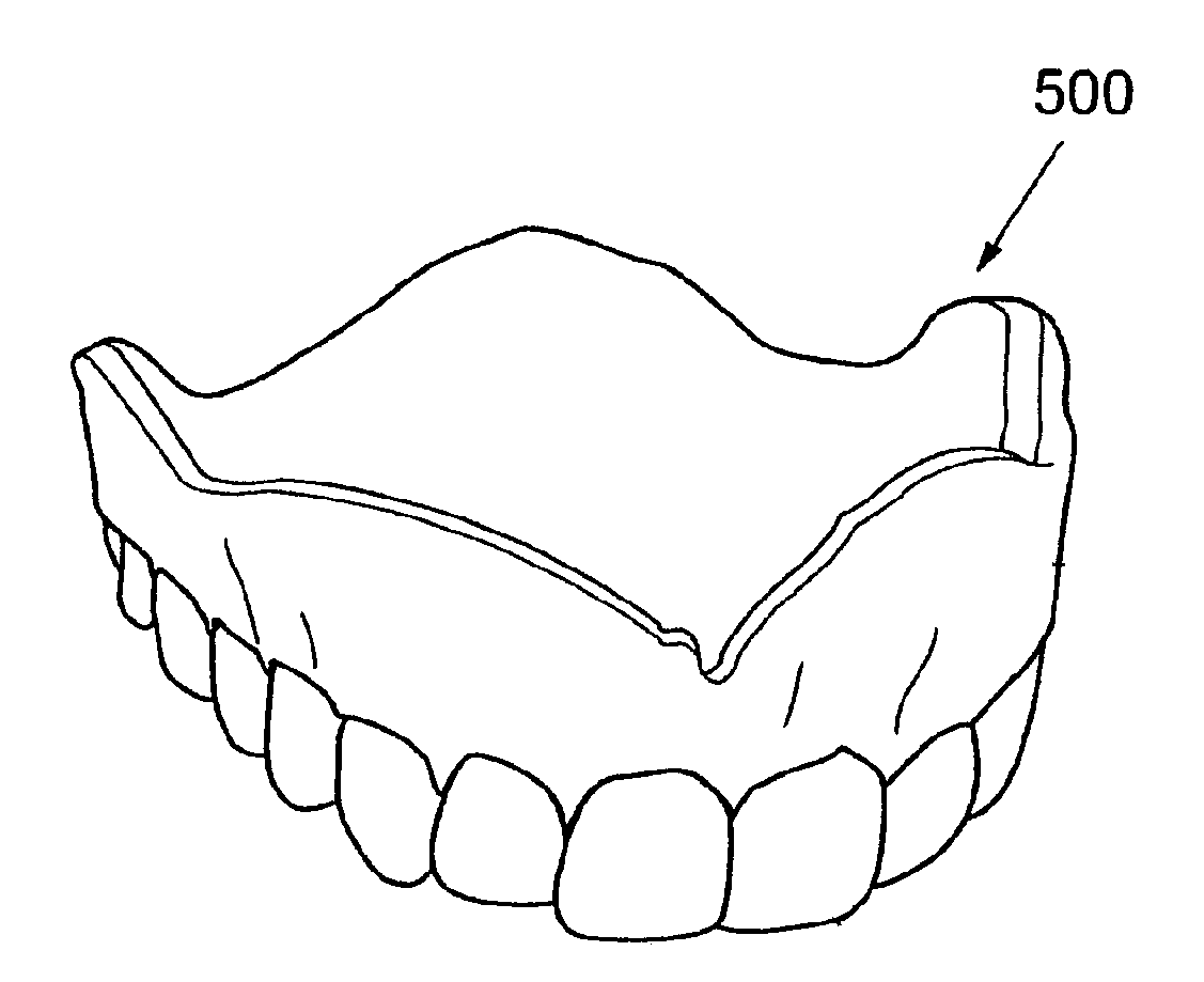 System and method for planning and/or producing a dental prosthesis