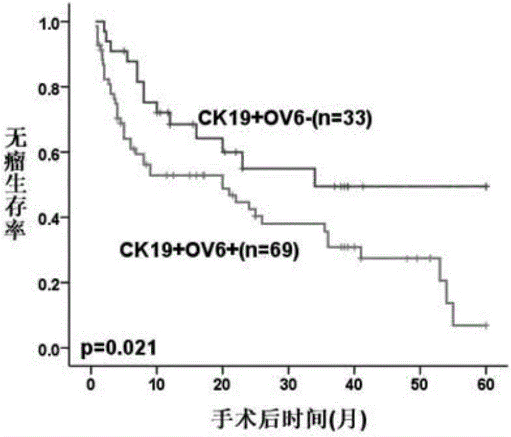 Application of ck19 combined with ov6 in preparation of liver cancer molecular typing kit and individualized treatment of liver cancer