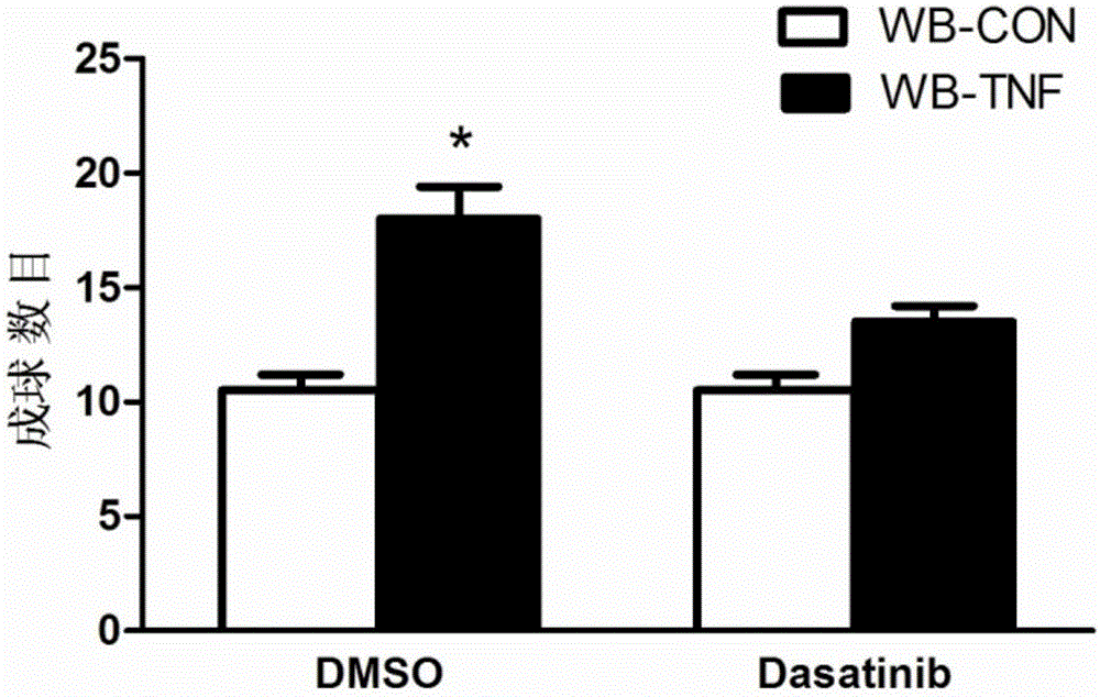 Application of ck19 combined with ov6 in preparation of liver cancer molecular typing kit and individualized treatment of liver cancer