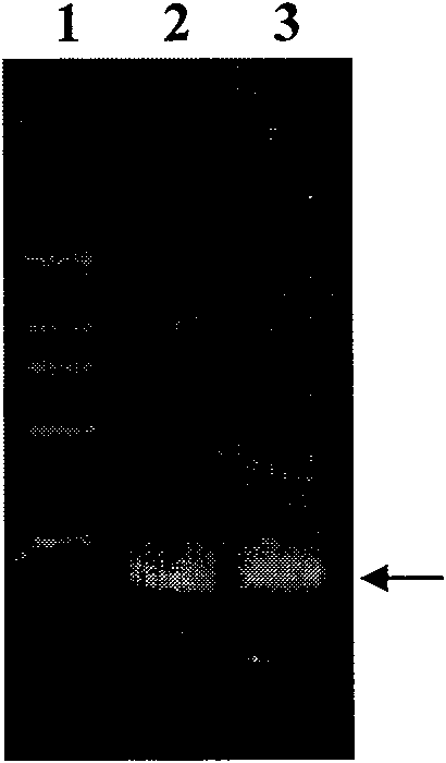 Lung cancer DNA plasmid vaccine and preparation method thereof