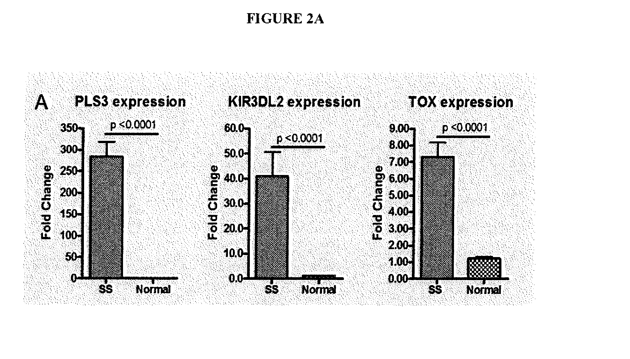 Method for diagnosis, prognosis and determination of treatment for cutaneous t-cell lymphoma