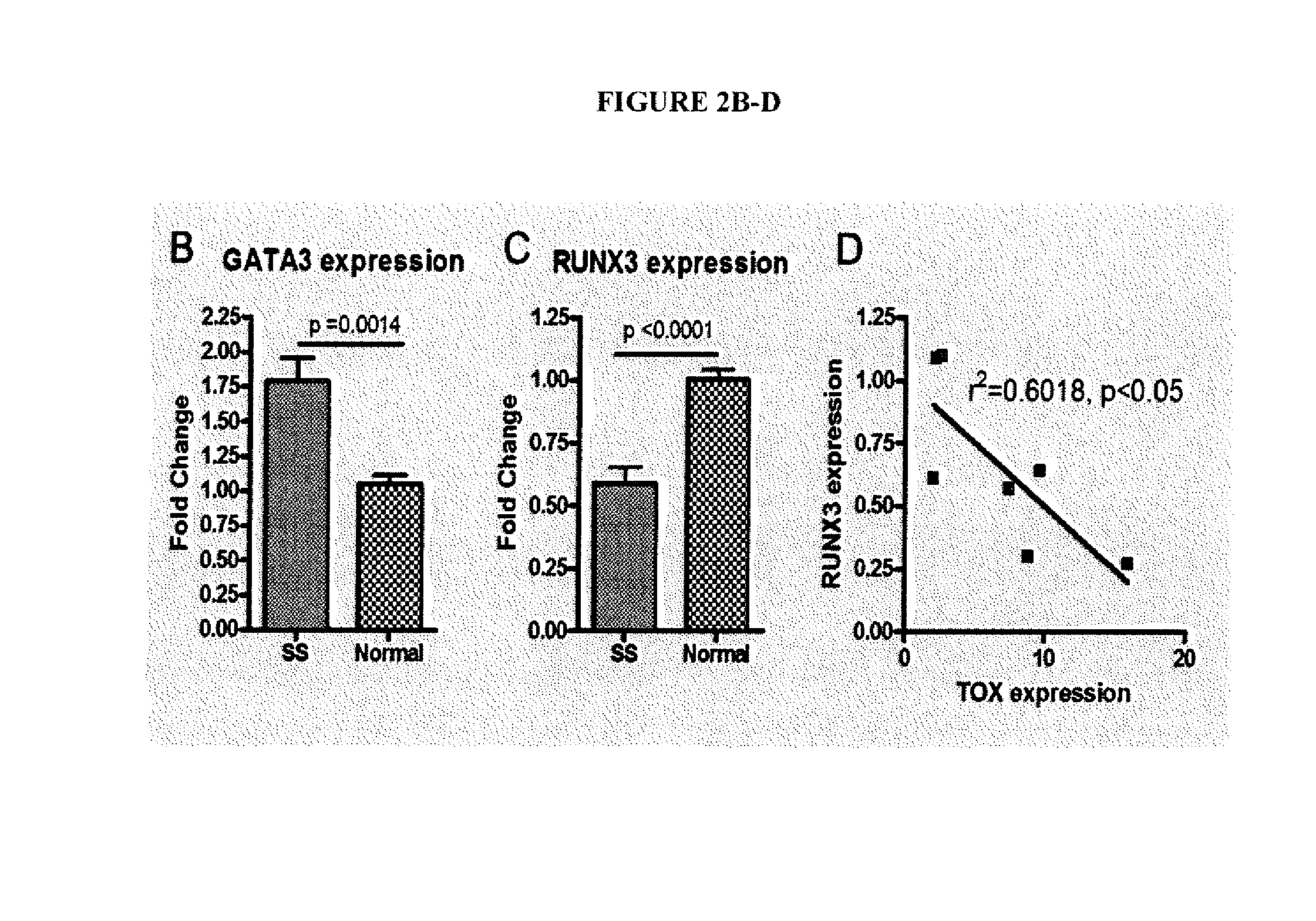 Method for diagnosis, prognosis and determination of treatment for cutaneous t-cell lymphoma