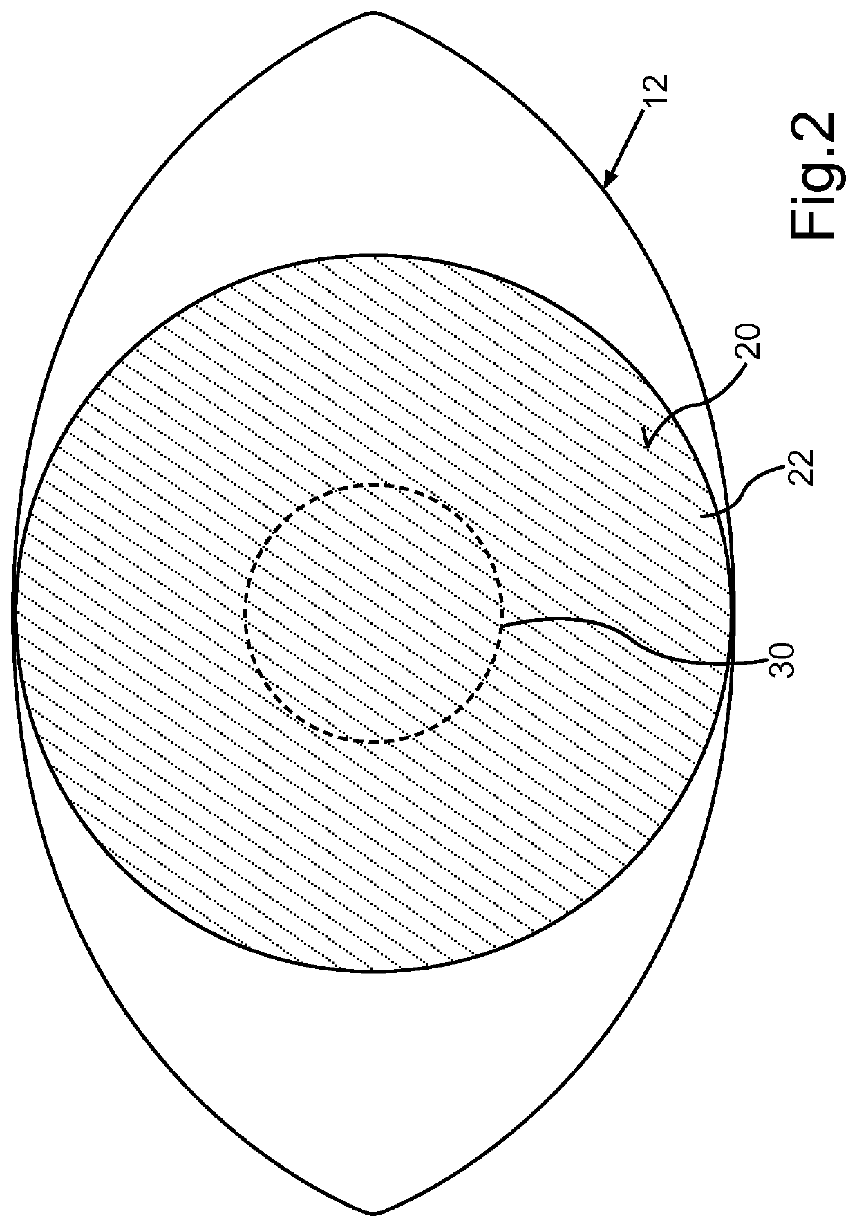 Treatment apparatus for correcting a refractive error of an eye