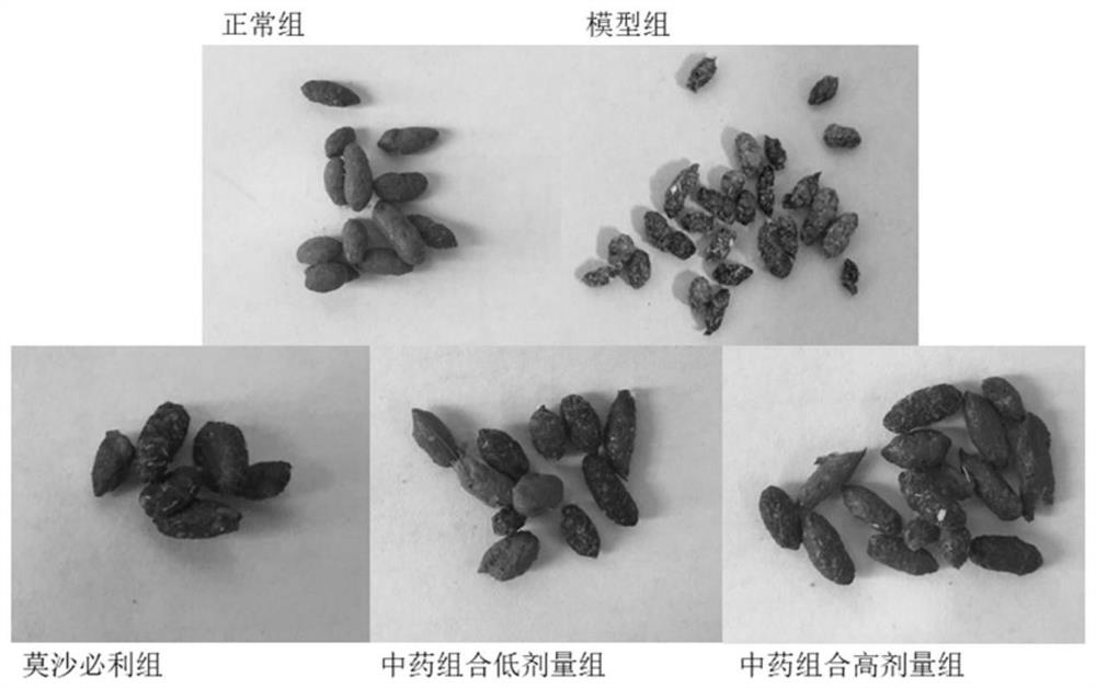 Novel traditional Chinese medicine composition for regulating lipid metabolism and improving gastrointestinal dysfunction