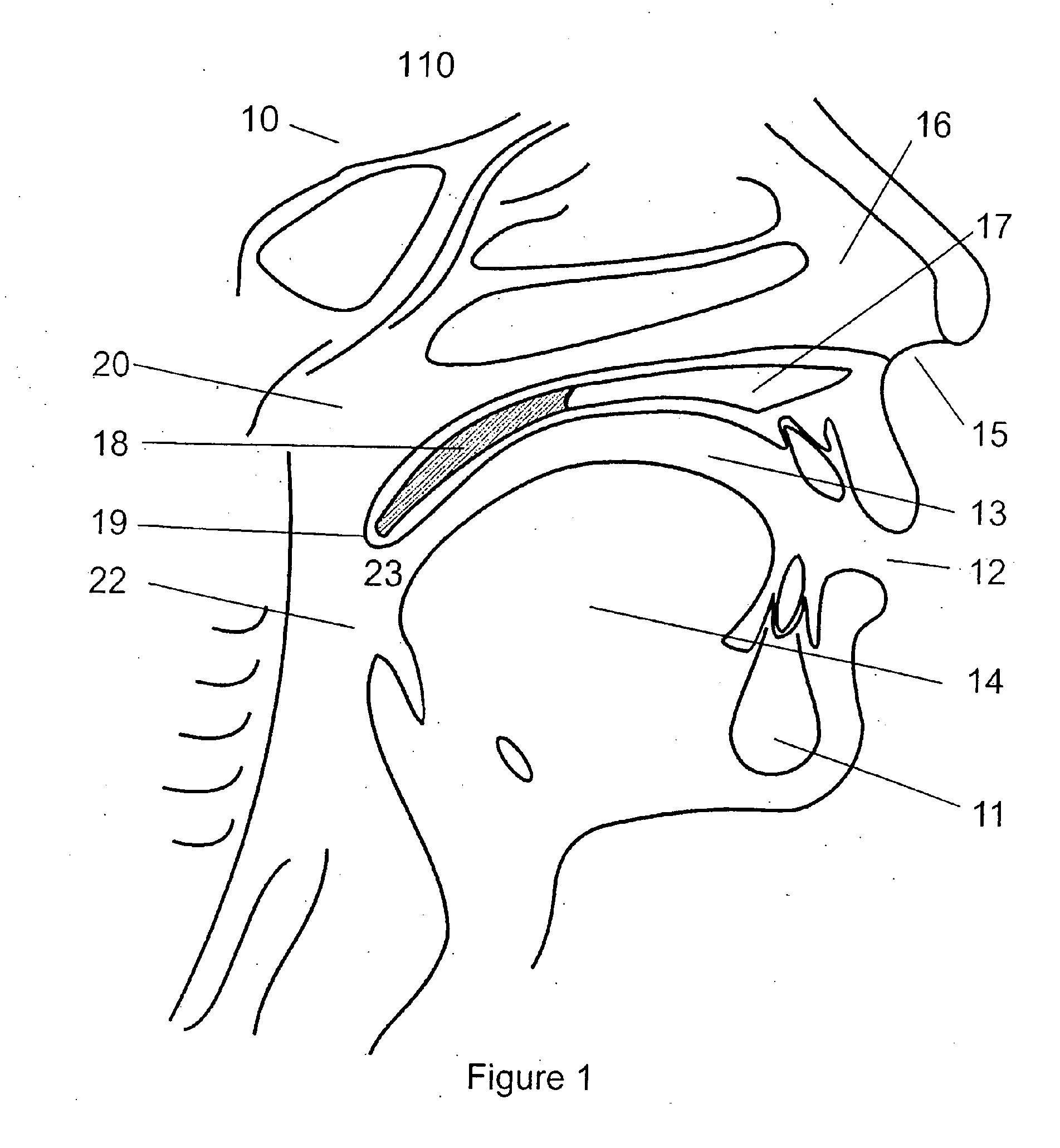 Device for strengthening soft palate muscles