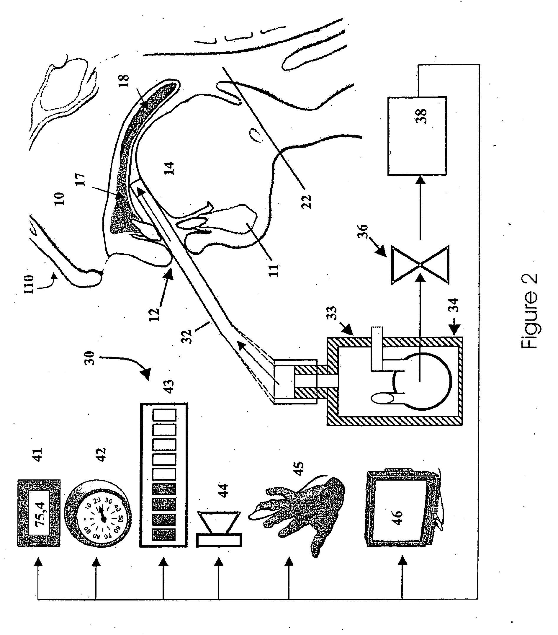Device for strengthening soft palate muscles