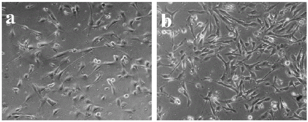 Preparation method of cornea repair material of double-layer structure