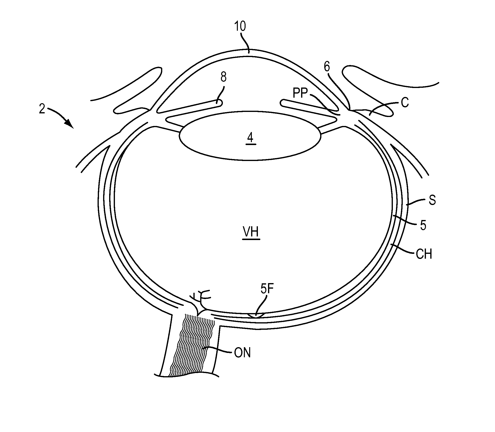 Eye covering and refractive correction methods and apparatus having improved tear flow, comfort, and/or applicability