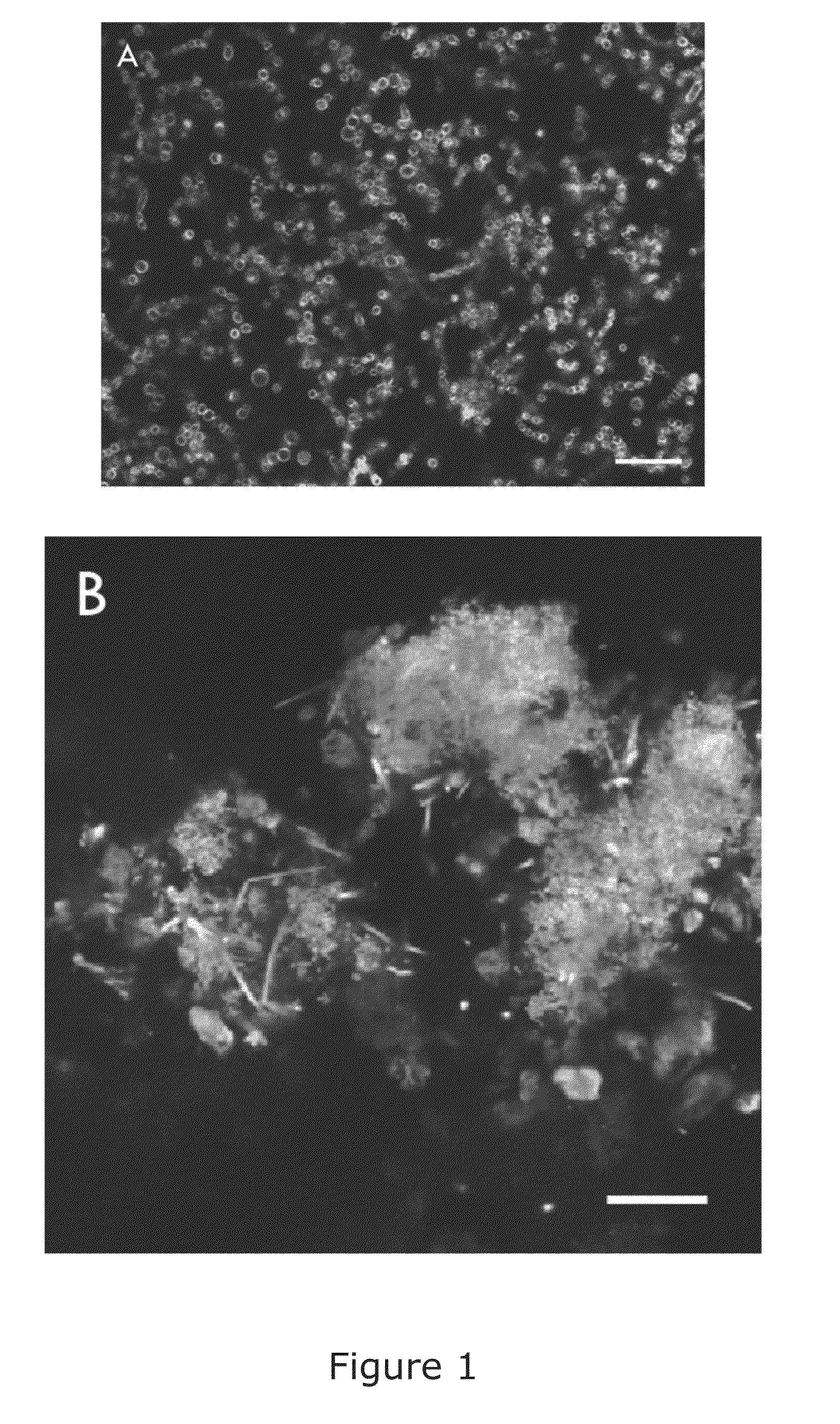 Nanoparticle aggregates containing osteopontin and calcium- and/or strontium-containing particles