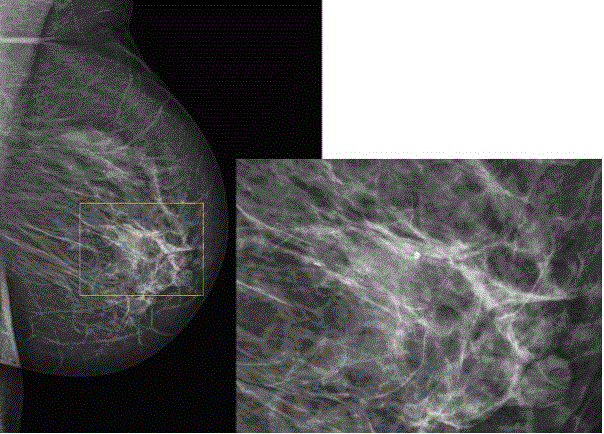 A multi-scale X-ray image enhancement method based on characteristics of a human visual system