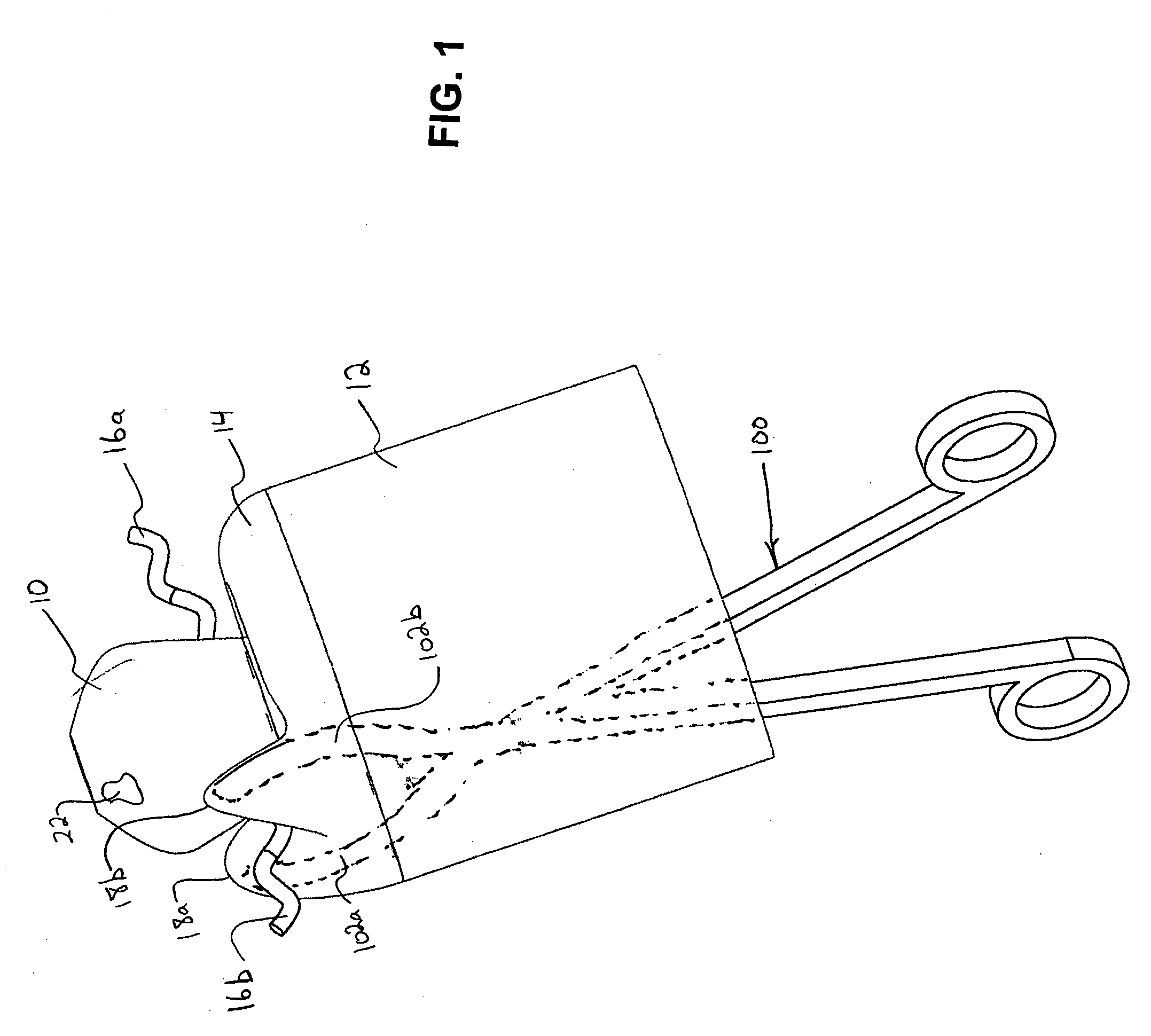 Methods for minimally-invasive, non-permanent occlusion of a uterine artery