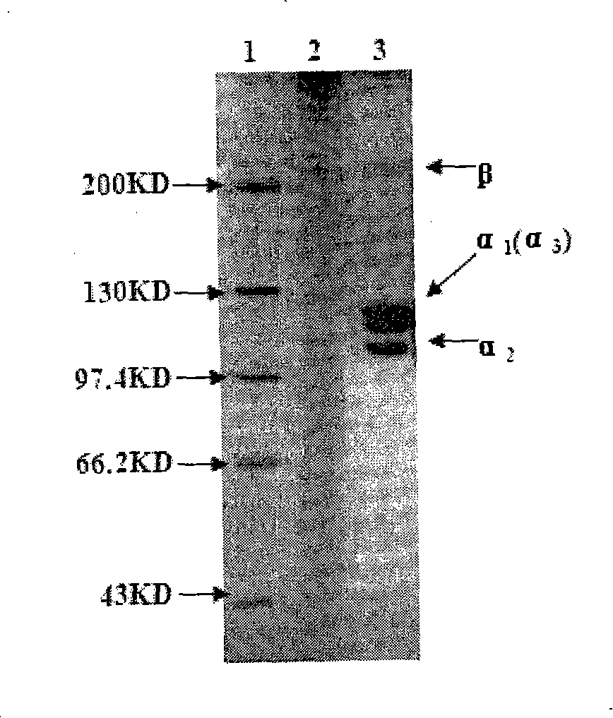 Method for preparing undenatured collagen from fish scale of fresh water fish