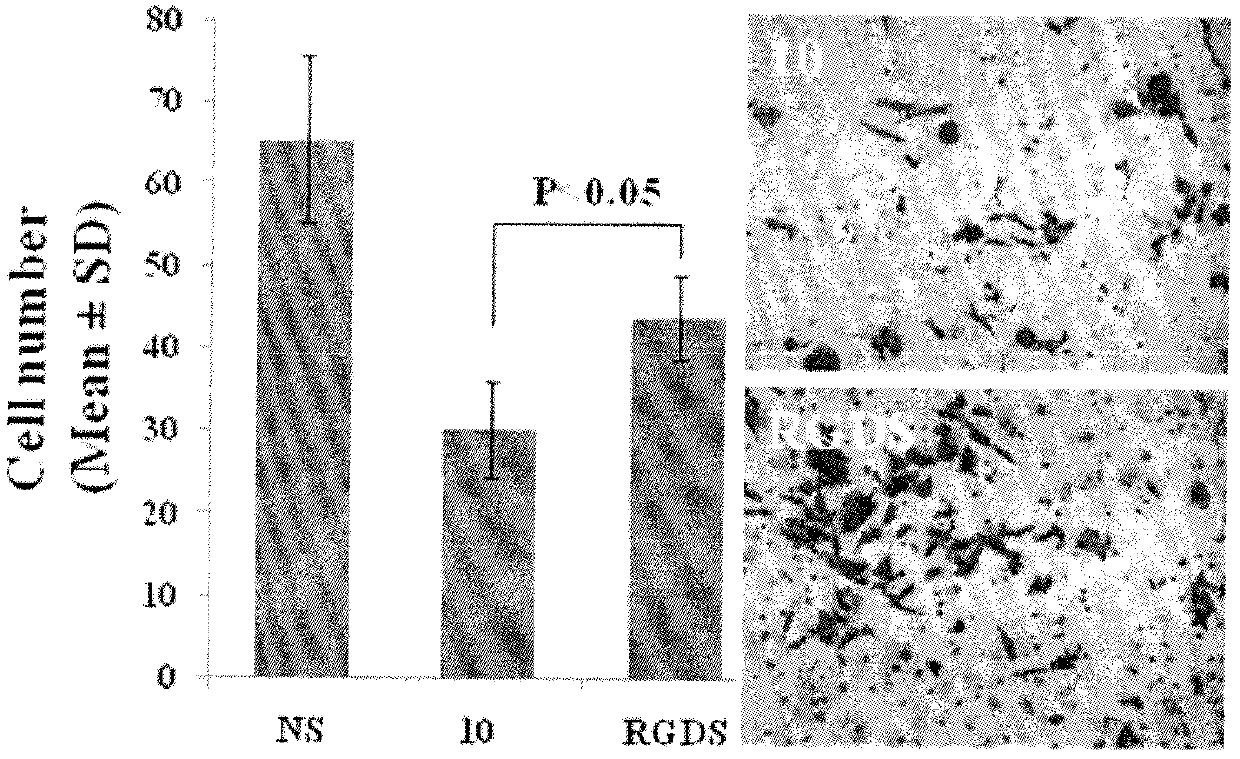 Curcumin modified by rgds, its preparation, biological activity and application